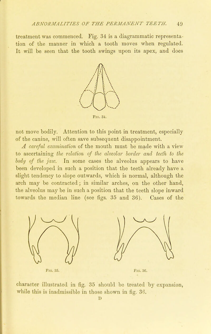 treatment was commenced. Fig. 34 is a diagrammatic representa- tion of the manner in which a tooth moves when regulated. It will be seen that the tooth swings upon its apex, and does not move bodily. Attention to this point in treatment, especially of the canine, will often save subsequent disappointment. A careful examination of the mouth must be made with a view to ascertaining the relation of the alveolar border and teeth to the body of the jaw. In some cases the alveolus appears to have been developed in such a position that the teeth already have a slight tendency to slope outwards, which is normal, although the arch may be contracted; in similar arches, on the other hand, the alveolus may be in such a position that the teeth slope inward towards the median line (see figs. 35 and 36). Cases of the character illustrated in fig. 35 should bo treated by expansion, while this is inadmissible in those shown in fig. 36. D