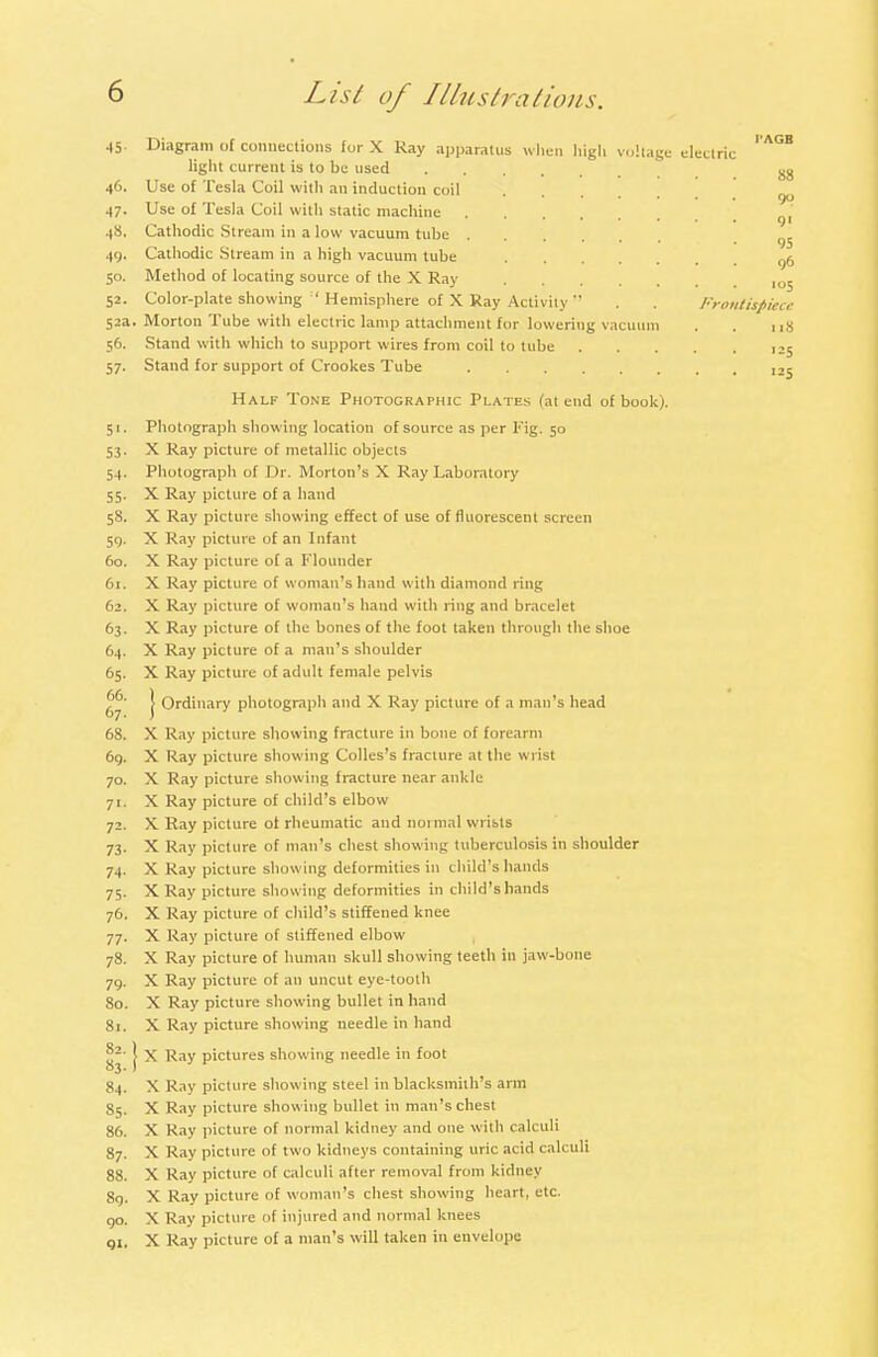 45. Diagram of connections for X Ray apparatus when high voltage electric ' A°B light current is to be used go 46. Use of Tesla Coil with an induction coil 47. Use of Tesla Coil with static machine ' 48. Cathodic Stream in a low vacuum tube ...... 49. Cathodic Stream in a high vacuum tube g6 50. Method of locating source of the X Ray 10J 52. Color-plate showing ' Hemisphere of X Ray Activity *' . . Frontispiece 52a. Morton Tube with electric lamp attachment for lowering vacuum . . 118 56. Stand with which to support wires from coil to tube 25 57. Stand for support of Crookes Tube I2j Half Tone Photographic Plates (at end of book). 51. Photograph showing location of source as per Pig. 50 53. X Ray picture of metallic objects 54. Photograph of Dr. Morton's X Ray Laboratory 55. X Ray picture of a hand 58. X Ray picture showing effect of use of fluorescent screen 59. X Ray picture of an Infant 60. X Ray picture of a Flounder 61. X Ray picture of woman's hand with diamond ring 62. X Ray picture of woman's hand with ring and bracelet 63. X Ray picture of the bones of the foot taken through the shoe 64. X Ray picture of a man's shoulder 65. X Ray picture of adult female pelvis J Ordinary photograph and X Ray picture of a man's head 68. X Ray picture showing fracture in bone of forearm 69. X Ray picture showing Colles's fracture at the wrist 70. X Ray picture showing fracture near ankle 71. X Ray picture of child's elbow 72. X Ray picture of rheumatic and normal wrists 73. X Ray picture of man's chest showing tuberculosis in shoulder 74. X Ray picture showing deformities in child's hands 75. X Ray picture showing deformities in child's hands 76. X Ray picture of child's stiffened knee 77. X Ray picture of stiffened elbow 78. X Ray picture of human skull showing teeth in jaw-bone 79. X Ray picture of an uncut eye-tooth 80. X Ray picture showing bullet in hand 81. X Ray picture showing needle in hand y2' J X Ray pictures showing needle in foot 84. X Ray picture showing steel in blacksmith's arm 85. X Ray picture showing bullet in man's chest 86. X Ray picture of normal kidney and one with calculi S7. X Ray picture of two kidneys containing uric acid calculi 88. X Ray picture of calculi after removal from kidney 89. X Ray picture of woman's chest showing heart, etc. 90. X Ray picture of injured and normal knees qi. X Ray picture of a man's will taken in envelope