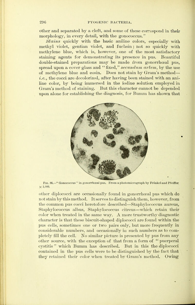 other and separated by a cleft, and some of these correspond in their morphology, in every detail, with the gonococcus. Stains quickly with the basic aniline colors, especially with methyl violet, gentian violet, and fuchsin; not so quickly with methylene blue, which is, however, one of the most satisfactory staining agents for demonstrating its presence in pus. Beautiful double-stained preparations may be made from gonorrhceal pus, spread upon a cover glass and fixed, secundum artem, by the use of methylene blue and eosin. Does not stain by Gram's method— i.e., the cocci are decolorized, after having been stained with an ani- line color, by being immersed in the iodine solution employed in Gram's method of staining. But this character cannot be depended upon alone for establishing the diagnosis, for Bumm has shown that Fig. 86.— Gonococcus  in gonorrhoea! pus. From a photomicrograph by Frankel and Pfeiffer, X 1,000. other diplococci are occasionally found in gonorrhceal pus which do not stain by this method. It serves to distinguish them, however, from the common pus cocci heretofore described—Staphylococcus aureus, Staphylococcus albus, Staphylococcus citreus—which retain their color when treated in the same way. A more trustworthy diagnostic character is that these biscuit-shaped diplococci are found within the pus cells, sometimes one or two pairs only, but more frequently in considerable numbers, and occasionally in such numbers as to com- pletely fill the cell. No similar picture is presented by pus from any other source, with the exception of that from a form of  puerperal cystitis which Bumm has described. But in this the diplococci contained in the pus cells were to be distinguished by the fact that they retained their color when treated by Gram's method. Owing