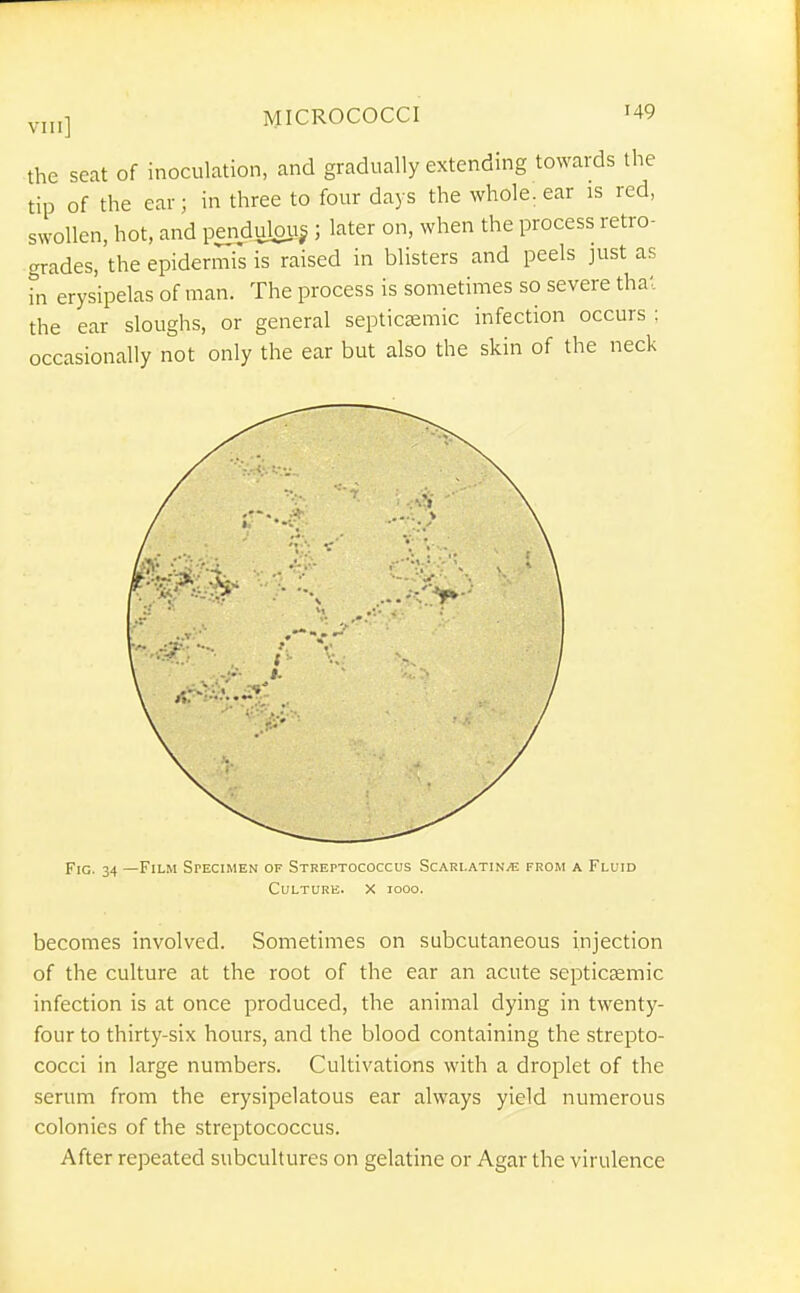 the seat of inoculation, and gradually extending towards the tip of the ear; in three to four days the whole, ear is red, swollen, hot, and pendubiij ; later on, when the process retro- grades, the epidermfs is raised in blisters and peels just as in erysipelas of man. The process is sometimes so severe tha'. the ear sloughs, or general septicsemic infection occurs ; occasionally not only the ear but also the skin of the neck Fig. 34 —Film Specimen of Streptococcus Scari.atinvE from a Fluid Culture. X iooo. becomes involved. Sometimes on subcutaneous injection of the culture at the root of the ear an acute septicaemic infection is at once produced, the animal dying in twenty- four to thirty-six hours, and the blood containing the strepto- cocci in large numbers. Cultivations with a droplet of the serum from the erysipelatous ear always yield numerous colonies of the streptococcus. After repeated subcultures on gelatine or Agar the virulence