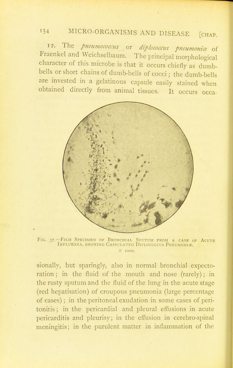 12. The p7te7imococcus or diplococcus pneumonice of Fraenkel and Wcichselbaum. The principal morphological character of this microbe is that it occurs chiefly as dumb- bells or short chains of dumb-bells of cocci; the dumb-bells are invested in a gelatinous capsule easily stained when obtained directly from animal tissues. It occurs occa- FiG. 37.—Film Specimen of Bronchial Sputum from a case of Acute Influenza, showing Capsulated Diplococcus Pneumoni/e. X 1000. sionally, but sparingly, also in normal bronchial expecto- ration ; in the fluid of the mouth and nose (rarely); in the rusty sputum and the fluid of the lung in the acute stage (red hepatisation) of croupous pneumonia (large percentage of cases); in the peritoneal exudation in some cases of peri- tonitis ; in the pericardial and pleural effusions in acute pericarditis and pleurisy; in the effusion in cerebro-spinal meningitis; in the purulent matter in inflammation of the