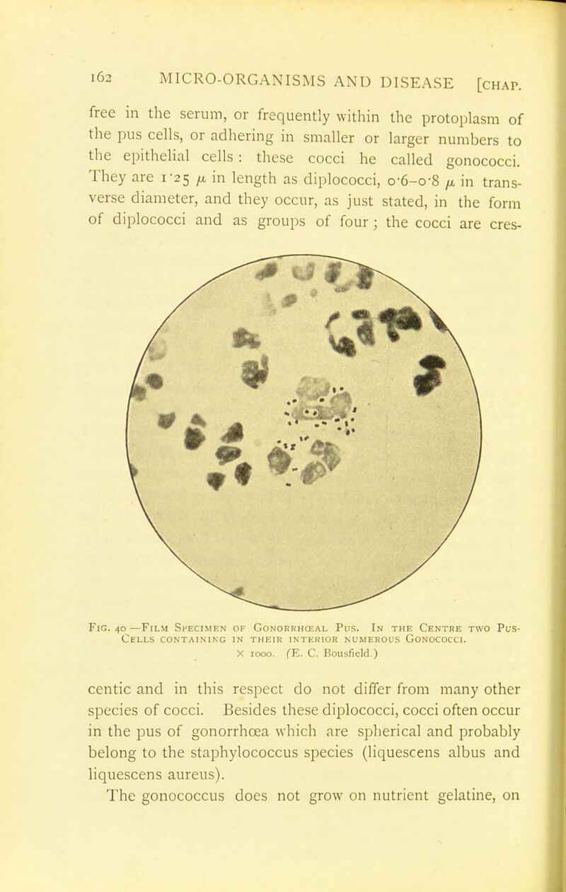 free in the serum, or frequently within the protoplasm of the pus cells, or adhering in smaller or larger numbers to the epithelial cells : these cocci he called gonococci. They are 1-25 /a in length as diplococci, o-6-o-8 in trans- verse diameter, and they occur, as just stated, in the form of diplococci and as groups of four; the cocci are cres- FiG. 40 —Film Specimen of Gonoerhceal Pus. In the Centre two Pus- Cells CONTAINING IN THEIR INTERIOR NUMEROUS GONOCOCCI. X 1000. fE. C. Bousfield.) centic and in this respect do not differ from many other species of cocci. Besides these diplococci, cocci often occur in the pus of gonorrhoea which are spherical and probably belong to the staphylococcus species (liquescens albus and liquescens aureus). The gonococcus does not grow on nutrient gelatine, on