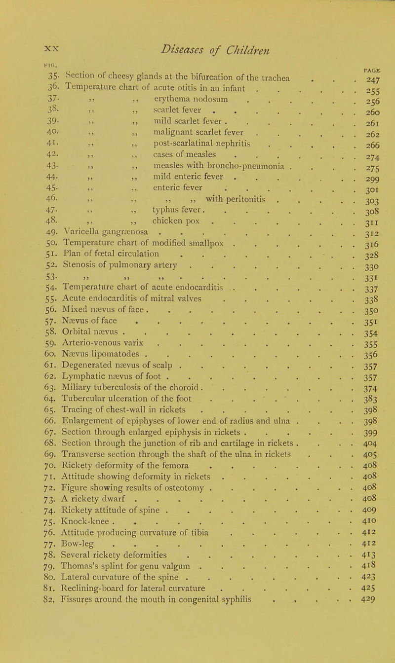 Klli. j5. section of cheesy glands at the bifurcation of the trachea . . .247 36. Temperature chart of acute otitis in an infant 255 37- >. ,, erythema nodosum ...... 256 3°* it ,j scarlet fever 260 39- >i mild scarlet fever 261 40. ,, ,, malignant scarlet fever 262 41- ,, post-scarlatinal nephritis 266 42- m cases of measles ....... 274 43- measles with broncho-pneumonia .... 275 44- >. mild enteric fever 299 45- >• enteric fever ....... 301 46- ,, ,, ,, with peritonitis 303 47- .1 >, typhus fever 308 48. ,, ,, chicken pox . . . . . ... 311 49. Varicella gangrenosa .......... 312 50. Temperature chart of modified smallpox 316 51. Plan of foetal circulation • , 328 52. Stenosis of pulmonary artery 330 53 >i j> n • • • • t . . . 33* 54. Temperature chart of acute endocarditis 337 55. Acute endocarditis of mitral valves 338 56. Mixed nrevus of face . .......... 350 57. Nrevus of face . . . . , . . . . . . 351 58. Orbital nrevus ............ 354 59. Arterio-venous varix .......... 355 60. Nrevus lipomatodes ........... 356 61. Degenerated nrevus of scalp ......... 357 62. Lymphatic nrevus of foot .......... 357 63. Miliary tuberculosis of the choroid ........ 374 64. Tubercular ulceration of the foot 383 65. Tracing of chest-wall in rickets ........ 398 66. Enlargement of epiphyses of lower end of radius and ulna . . . . 398 67. Section through enlarged epiphysis in rickets ...... 399 68. Section through the junction of rib and cartilage in rickets . . . . 404 69. Transverse section through the shaft of the ulna in rickets . . . 405 70. Rickety deformity of the femora ........ 408 71. Attitude showing deformity in rickets ....... 408 72. Figure showing results of osteotomy ........ 408 73. A rickety dwarf 408 74. Rickety attitude of spine .......... 4°9 75. Knock-knee 4'° 76. Attitude producing curvature of tibia . . . • • . . 412 77. Bow-leg 412 78. Several rickety deformities ......... 4J3 79. Thomas's splint for genu valgum ........ 4J8 80. Lateral curvature of the spine ......... 423 81. Reclining-board for lateral curvature ....... 42S 82. Fissures around the mouth in congenital syphilis 429