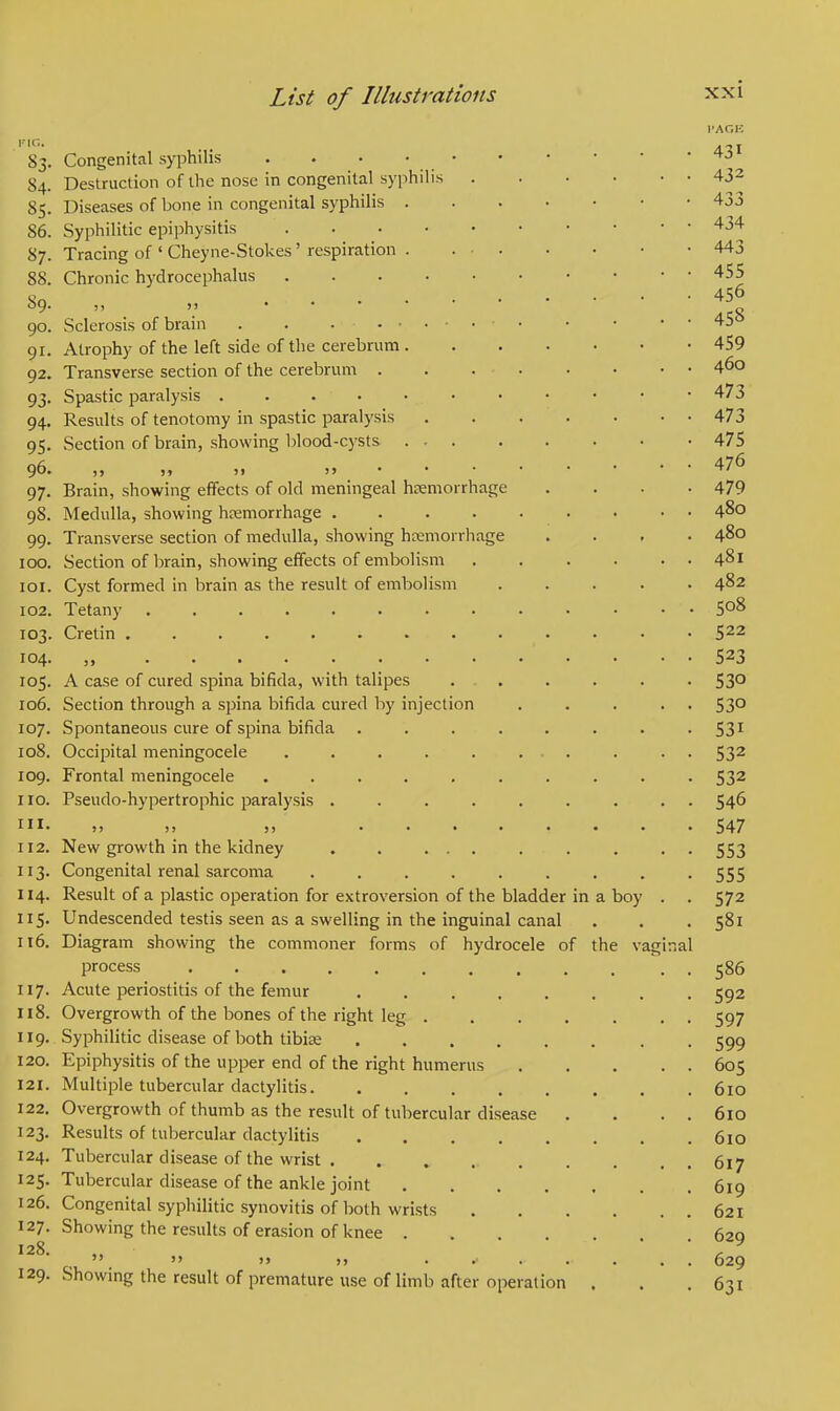 S3- 84. 85- 86. 87. 88. S9. 90. 91. 92. 93- 94. 95- 96. 97- 98. 99. 100. 101. 102. 103. 104. 105. 106. 107. 108. 109. 110. in. 112. 113. 114. 5- 116. 117. 118. 119. 120. 121. 122. I23. I24. 125- 126. 127. 128. I29. List of Illustrations Congenital syphilis Destruction of the nose in congenital syphilis Diseases of bone in congenital syphilis . Syphilitic epiphysitis .... Tracing of ' Cheyne-Stokes' respiration . Chronic hydrocephalus .... ), >> .... Sclerosis of brain . . .... Atrophy of the left side of the cerebrum . Transverse section of the cerebrum . Spastic paralysis Results of tenotomy in spastic paralysis Section of brain, showing blood-cysts . - It )» 51 j» • • Brain, showing effects of old meningeal haemorrhage Medulla, showing hemorrhage .... Transverse section of medulla, showing haemorrhage Section of brain, showing effects of embolism Cyst formed in brain as the result of embolism Tetany ........ Cretin ........ ,, ........ A case of cured spina bifida, with talipes Section through a spina bifida cured by injection Spontaneous cure of spina bifida Occipital meningocele ..... Frontal meningocele ..... Pseudo-hypertrophic paralysis .... ») )> )> ... New growth in the kidney . . ... Congenital renal sarcoma .... Result of a plastic operation for extroversion of the bladder in a boy Undescended testis seen as a swelling in the inguinal canal Diagram showing the commoner forms of hydrocele of the vaginal process . Acute periostitis of the femur .... Overgrowth of the bones of the right leg . Syphilitic disease of both tibiae .... Epiphysitis of the upper end of the right humerus Multiple tubercular dactylitis Overgrowth of thumb as the result of tubercular disease Results of tubercular dactylitis .... Tubercular disease of the wrist Tubercular disease of the ankle joint Congenital syphilitic synovitis of both wrists Showing the results of erasion of knee .  7J jj • r Showing the result of premature use of limb after operat ion XXI PAGE 431 432 433 434 443 455 456 458 459 460 473 473 475 476 479 480 480 481 482 508 522 523 53° 530 53i 532 532 546 547 553 555 572 58i 586 592 597 599 605 610 610 610 617 619 621 629 629 631