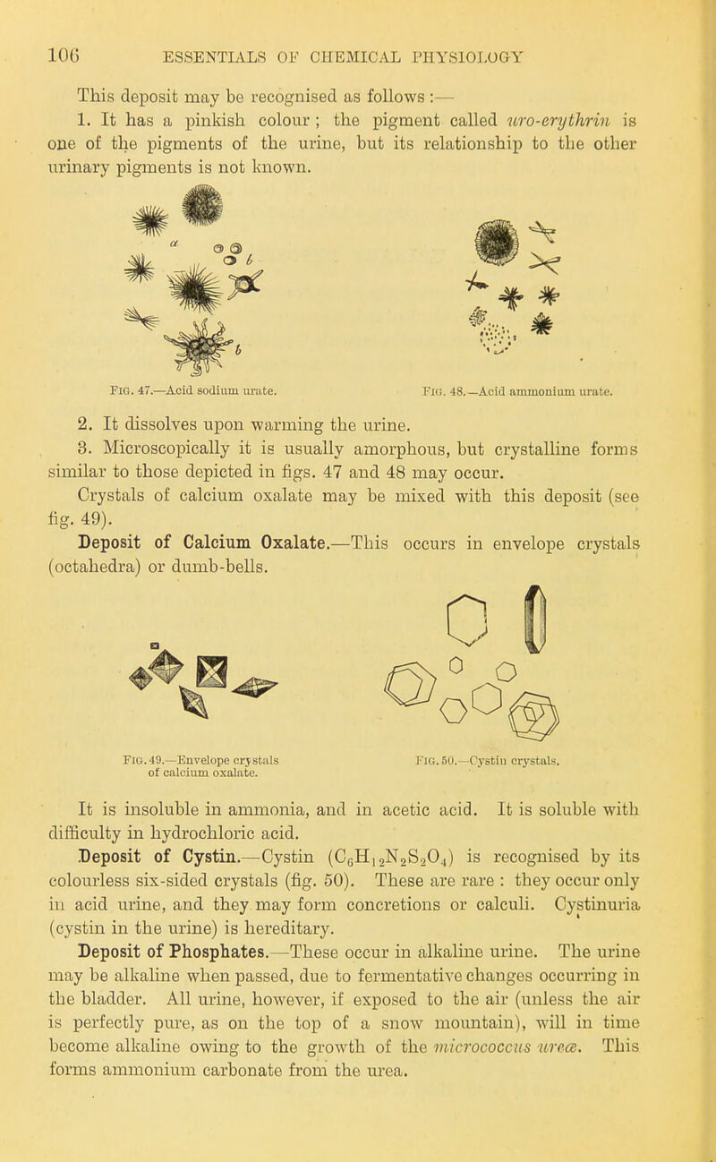 This deposit may be recognised as follows :— 1. It has a pinkish colour ; the pigment called uro-Grythrin is one of the pigments of the urine, but its relationship to the other iirinary pigments is not known. Fig. 47.—Acid sodium m-ate. Fig. 48. —Acid ammonium urate. 2, It dissolves upon warming the urine. 3. Microscopically it is usually amorphous, but crystalline forms similar to those depicted in figs. 47 and 48 may occur. Crystals of calcium oxalate may be mixed with this deposit (see fig. 49). Deposit of Calcium Oxalate.—This occurs in envelope crystals (octahedra) or dumb-bells. Fig.49.—Envelope crjsfcals Fig. 50.—Cystiu crystals, of calcium oxalate. It is insoluble in ammonia, and in acetic acid. It is soluble with difficulty in hydrochloric acid. Deposit of Cystin.—Cystin (C(jH,2N2S204) is recognised by its colourless six-sided crystals (fig. 50). These are rare : they occur only in acid urine, and they may form concretions or calculi. Cystinuria (cystin in the urine) is hereditary. Deposit of Phosphates.—These occur in alkaline urine. The urine may be alkaline when passed, due to fermentative changes occurring in the bladder. All urine, however, if exposed to the air (unless the air is perfectly pure, as on the top of a snoAV mountain), will in time become alkaline owing to the growth of the micrococcus urecB. This forms ammonium carbonate from the urea.