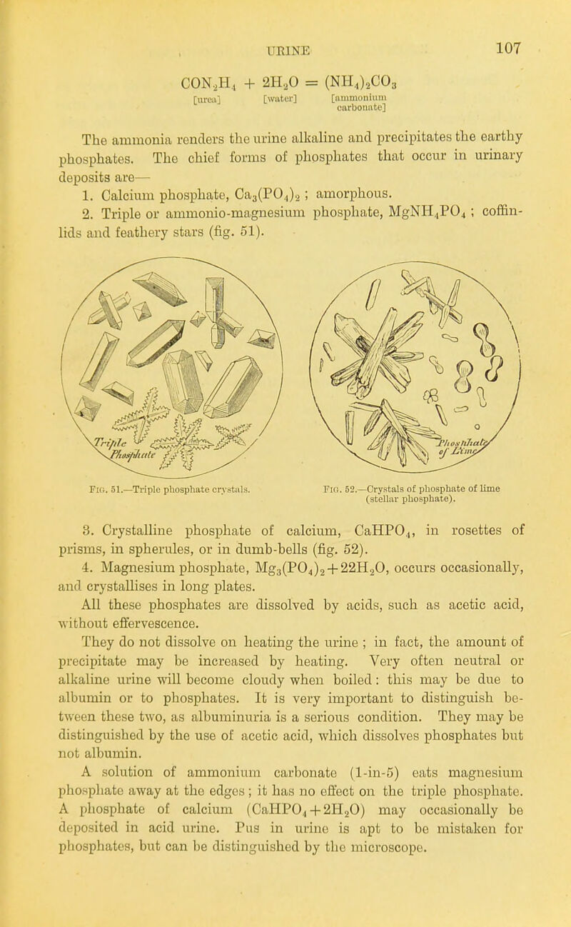 CON,H, + 2H2O = (NH4)2C03 [urciij [water] [ammonium carbonate] The ammonia renders the urine alkaline and precipitates the earthy phosphates. The chief forms of phosphates that occur in urinary deposits are— 1. Calcium phosphate, Ca3(PO,,).2 ; amorphous. 2. Triple or ammonio-magnesium phosphate, MgNH,iP04 ; coffin- lids and feathery stars (fig. 51). Fid. 51.—Triple pliospliate crystals. Fifi. 52.—Crystals of phosphate of lime (stellar phosphate). 3. Crystalline phosphate of calcium, CaHP04, in rosettes of prisms, in spherules, or in dumb-bells (fig. 52). 4. Magnesium phosphate, Mg3(P04)2 + 22H20, occurs occasionally, and crystallises in long plates. All these phcsphates are dissolved by acids, such as acetic acid, ■without effervescence. They do not dissolve on heating the urine ; in fact, the amount of precipitate may be increased by heating. Very often neutral or alkaline urine will become cloudy when boiled: this may be due to albumin or to phosphates. It is very important to distinguish be- tween these two, as albuminuria is a serious condition. They may be distinguished by the use of acetic acid, which dissolves phosphates but not albumin. A solution of ammonium carbonate (l-in-5) eats magnesium phosphate away at the edges ; it has no effect on the triple phosphate. A phosphate of calcium (CaHP04-f 2H2O) may occasionally be deposited in acid urine. Pus in urine is apt to be mistaken for phosphates, but can be distinguished by the microscope.