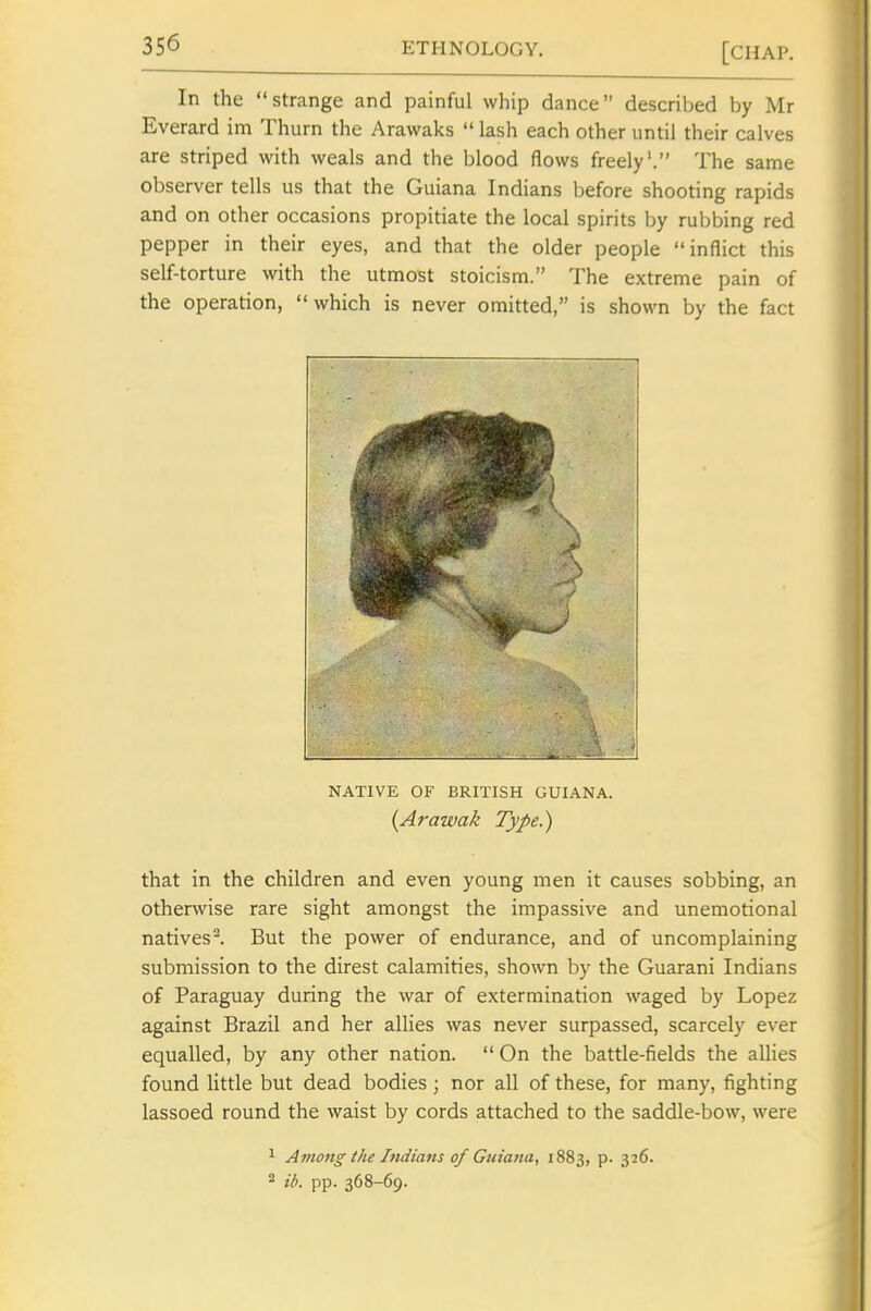 In the strange and painful whip dance described by Mr Everard im Thurn the Arawaks  lash each other until their calves are striped with weals and the blood flows freely'. The same observer tells us that the Guiana Indians before shooting rapids and on other occasions propitiate the local spirits by rubbing red pepper in their eyes, and that the older people inflict this self-torture with the utmost stoicism. The extreme pain of the operation, which is never omitted, is shown by the fact NATIVE OF BRITISH GUIANA. {Arawak Type.) that in the children and even young men it causes sobbing, an otherwise rare sight amongst the impassive and unemotional natives-. But the power of endurance, and of uncomplaining submission to the direst calamities, shown by the Guarani Indians of Paraguay during the war of extermination waged by Lopez against Brazil and her allies was never surpassed, scarcely ever equalled, by any other nation.  On the battle-fields the allies found little but dead bodies ; nor all of these, for many, fighting lassoed round the waist by cords attached to the saddle-bow, were ^ Among the Indians of Guiana, 1883, p. 326. 2 ib. pp. 368-69.