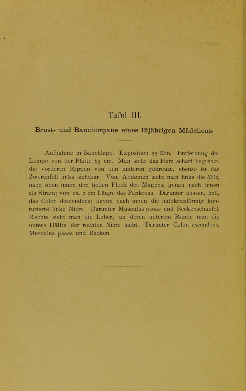 Brust- und Bauchorgane eines 12jährigen Mädchens. Aufnahme in Bauchlage. Exposition 55 Min. Entfernung der Lampe von der Platte 65 cm. Man sieht das Herz scharf begrenzt, die vorderen Rippen von den hinteren gekreuzt, ebenso ist das Zwerchfell links sichtbar. Vom Abdomen sieht man links die Milz, nach oben innen den hellen Fleck des Magens, genau nach innen als Strang von ca. 2 cm Länge das Pankreas. Darunter aussen, hell, das Colon descendens; davon nach innen die halbkreisförmig kon- turierte linke Niere. Darunter Musculus psoas und Beckenschaufel. Rechts sieht man die Leber, an deren unterem Rande man die untere Hälfte der rechten Niere sieht. Darunter Colon ascendens, Musculus psoas und Becken.