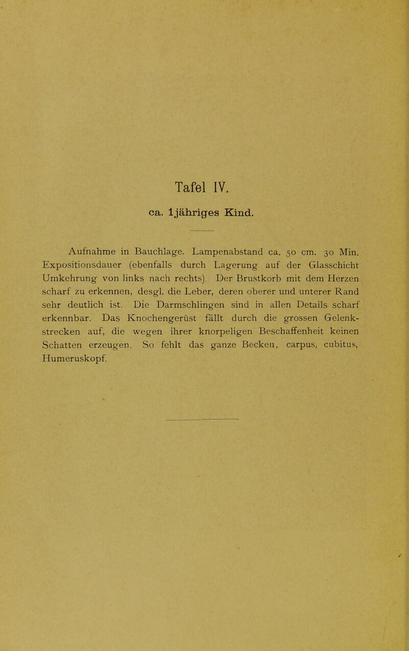 ca. Ijähriges Kind. Aufnahme in Bauchlage. Lampenabstand ca. 50 cm. 30 Min. Expositionsdauer (ebenfalls durch Lagerung auf der Glasschicht Umkehrung von links nach rechts). Der Brustkorb mit dem Herzen scharf zu erkennen, desgl. die Leber, deren oberer und unterer Rand sehr deutlich ist. Die Darmschlingen sind in allen Details scharf erkennbar. Das Knochengerüst fällt durch die grossen Gelenk- strecken auf, die wegen ihrer knorpeligen Beschaffenheit keinen Schatten erzeugen. So fehlt das ganze Becken, carpus, cubitus, Humeruskopf.