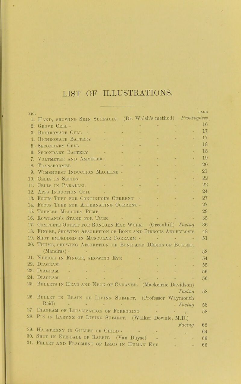 LIST OF ILLUSTRATIONS. KIG. 1. Hand, showing Skin Surfaces. (Dr. Walsh's method) FroHtis])iecc 2. Grove Cell -------- 16 3. Bichromate Celt, - - - - - - - 1/ 4. Bichromate Battej'.y - - - - - - 17 5. Seconda-ry Cell - - - - - - - 18 6. Secondary Battery - - - - - - 18 7. Voltmeter and Ammeter - - - - - - 19 8. Transformer ------- 20 9. WiMSHURST Induction Machine - - - - - 21 10. Cells in Series ------- 22 11. Cells in Parallel - - - - - - 22 12. Aprs Induction Coil - - - - - - 24 1.3. Focus Tube for Continuous Current - - - - 27 14. Focus Tube for Alternating Current - - - - 27 \f<. Toepler Mercury Pump - - - - - - 29 16. Eowland's Stand for Tube - - - - - 35 17. Complete Outfit for RoNTGEN Eay Work. (Greeiihill) Facing 36 18. Finger, .showing Absorption of Bone and Fibrous Anchylosis 48 19. Shot embedded in Muscular Forearm - - - - 51 20. Thumb, showing Absorption of Bone and Debris of Bullet. (Mandras) - - - - - ' - - - 53 21. Needle in Finger, showing Eye - - - - 54 22. Diagram 55 23. Diagram ........ 24. Diagram 5g 25. Bullets in Head and Neck of Cadaver. (Mackenzie Davidson) Faciiuj 58 26. Bullet in Brain of Living Subject. (Professor Wayniouth Rcid) Faciiuj 58 27. Diagram of Localization of Foregoing - - ,, 58 28. Pin is Larynx of Living Subject. (Walker Downie, M.D.) Facing 62 29. Halfpenny IN Gullet OF Child - - - - 64 30. Shot in Eye-hall of Rabbit. (Van Duyse) - - - 66 31. Pellet and Fp.agment of Lead in Human Eye - - 66