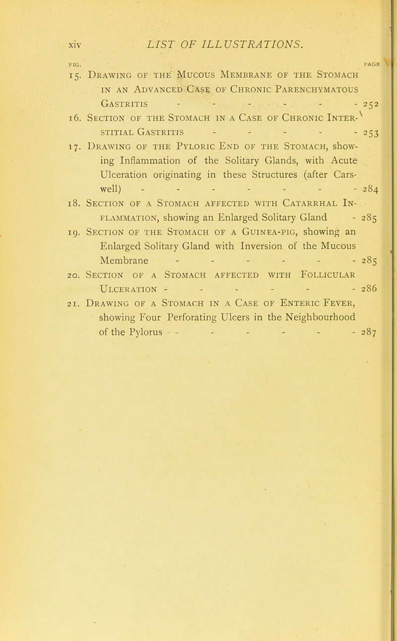 I'lG. I'AGR \ 15. Drawing of the Mucous Membrane of the Stomach • IN AN Advanced CAse of Chronic Parenchymatous Gastritis - - - - - - 252 16. Section of the Stomach in a Case of Chronic Inter-^ STiTiAL Gastritis . . . . . 253 17. Drawing of the Pyloric End of the Stomach, show- ing Inflammation of the Sohtary Glands, with Acute Ulceration originating in these Structures (after Cars- well) ------- 284 18. Section of a Stomach affected with Catarrhal In- flammation, showing an Enlarged Solitary Gland - 285 19. Section of the Stomach of a Guinea-pig, showing an Enlarged Solitary Gland with Inversion of the Mucous Membrane ------ 285 20. Section of a Stomach affected with Follicular Ulceration ----- - 286 21. Drawing of a Stomach in a Case of Enteric Fever, showing Four Perforating Ulcers in the Neighbourhood of the Pylorus ------ 287 i I : t