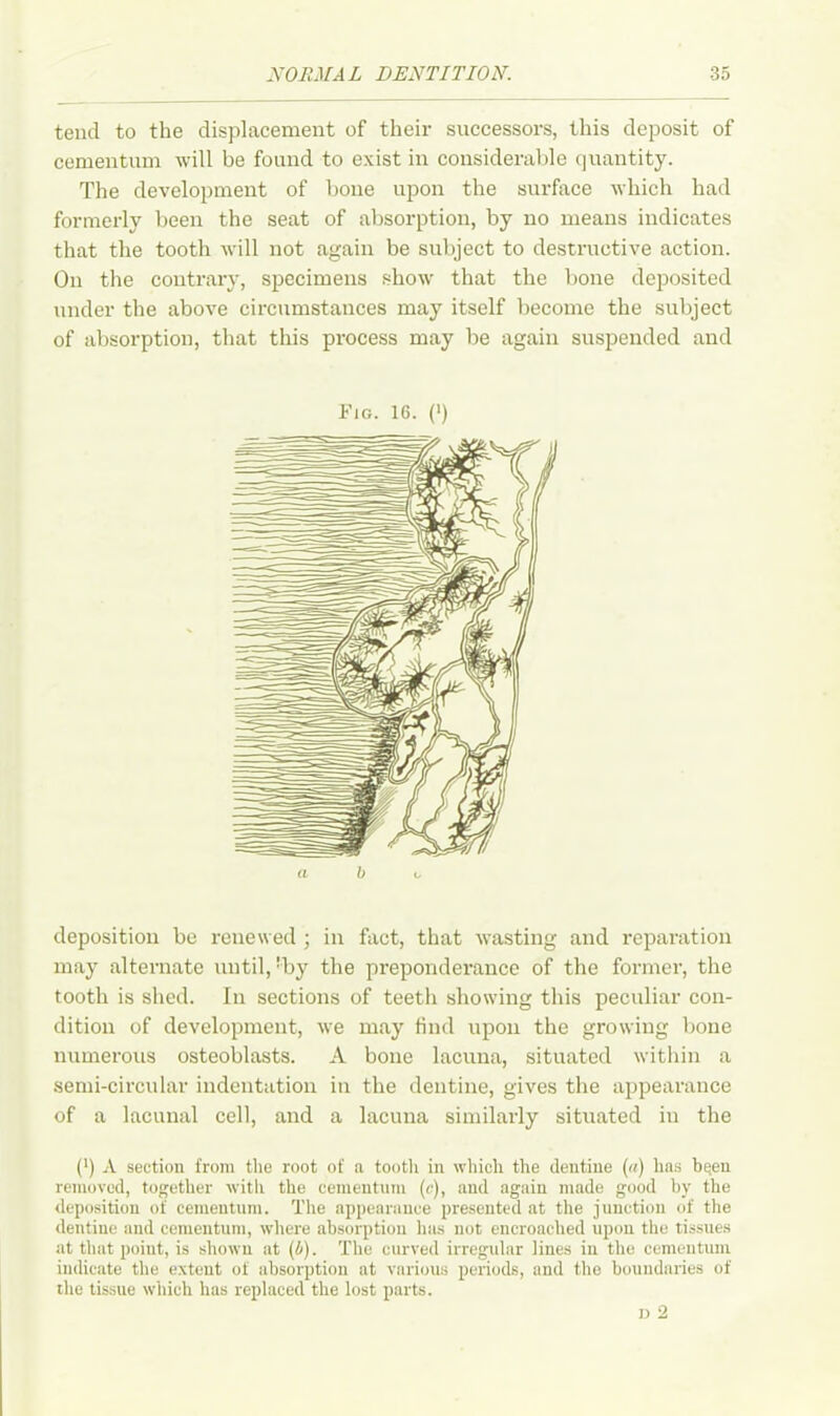 tend to the displacement of their successors, this deposit of cementum will be found to exist in considerable quantity. The development of bone upon the surface which had formerly been the seat of absorption, by no means indicates that the tooth will not again be subject to destructive action. On the contrary, specimens show that the bone deposited under the above circumstances may itself become the subject of absorption, that this process may be again suspended and Fig. 16. (') deposition be renewed ; in fact, that wasting and reparation may alternate until, !by the preponderance of the former, the tooth is shed. In sections of teeth showing this peculiar con- dition of development, we may find upon the growing bone numerous osteoblasts. A bone lacuna, situated within a semi-circular indentation in the dentine, gives the appearance of a lacunal cell, and a lacuna similarly situated iu the (>) A section from the root of a tooth in which the dentine (a) lias been removed, together with the cementum (e), and again made good by the deposition of cementum. The appearance presented at the junction of the dentine and cementum, where absorption has not encroached upon the tissues at that point, is shown at (5). The curved irregular lines in the cementum indicate the extent of absorption at various periods, and the boundaries of the tissue which has replaced the lost parts.