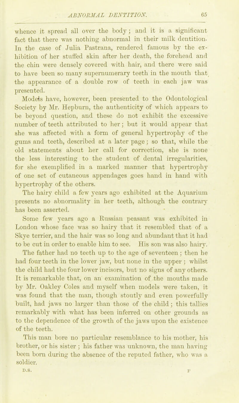 whence it spread all over the body; and it is a significant fact that there was nothing abnormal in their milk dentition. In the case of Julia Pastrana, rendered famous by the ex- hibition of her stuffed skin after her death, the forehead and the chin were densely covered with hair, and there were said to have been so many supernumerary teeth in the mouth that the appearance of a double row of teeth in each jaw was presented. Models have, however, been presented to the Odontological Society by Mr. Hepburn, the authenticity of which appears to be beyond question, and these do not exhibit the excessive number of teeth attributed to her; but it would appear that she was affected with a form of general hypertrophy of the gums and teeth, described at a later page; so that, while the old statements about her call for correction, she is none the less interesting to the student of dental irregularities, for she exemplified in a marked manner that hypertrophy of one set of cutaneous appendages goes hand in hand with hypertrophy of the others. The hairy child a few years ago exhibited at the Aquarium presents no abnormality in her teeth, although the contrary has been asserted. Some few years ago a Russian peasant was exhibited in London whose face was so hairy that it resembled that of a Skye terrier, and the hair was so long and abundant that it had to be cut in order to enable him to see. His son was also hairy. The father had no teeth up to the age of seventeen ; then he had four teeth in the lower jaw, but none in the upper ; whilst the child had the four lower incisors, but no signs of any others. It is remarkable that, on an examination of the mouths made by Mr. Oakley Coles and myself when models were taken, it was found that the man, though stoutly and even powerfully built, had jaws no larger than those of the child; this tallies remarkably with what has been inferred on other grounds as to the dependence of the growth of the jaws upon the existence of the teeth. This man bore no particular resemblance to his mother, his brother, or his sister ; his father was unknown, the man having been born during the absence of the reputed father, who was a soldier. D.S. F