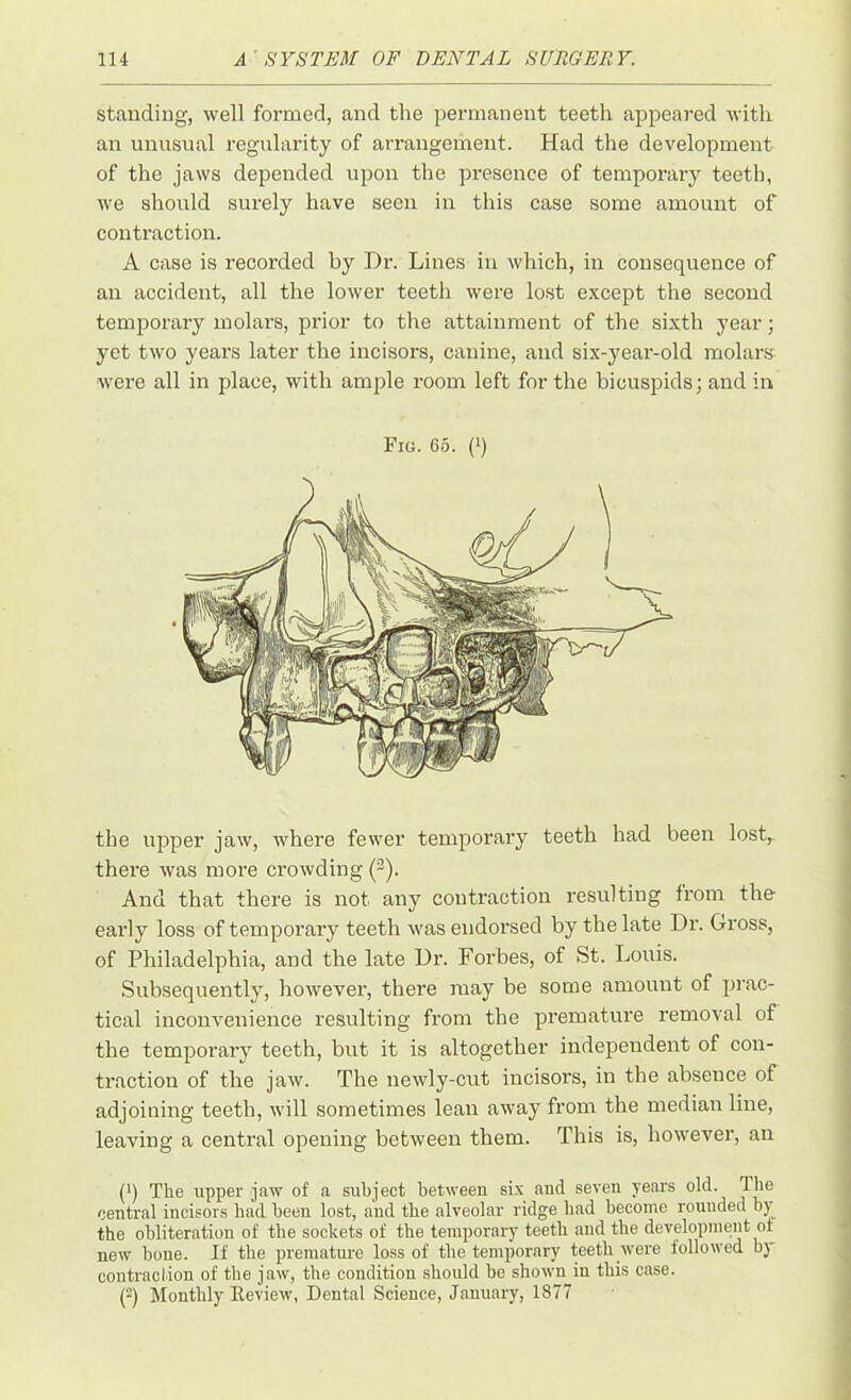 standing, well formed, and the permanent teeth appeared with an unusual regularity of arrangement. Had the development of the jaws depended upon the presence of temporary teeth, we should surely have seen in this case some amount of contraction. A case is recorded by Dr. Lines in which, in consequence of an accident, all the lower teeth were lost except the second temporary molars, prior to the attainment of the sixth year; yet two years later the incisors, canine, and six-year-old molars were all in place, with ample room left for the bicuspids; and in Fig. 65. (') the upper jaw, where fewer temporary teeth had been lost, there was more crowding (3). And that there is not any contraction resulting from the early loss of temporary teeth was endorsed by the late Dr. Gross, of Philadelphia, and the late Dr. Forbes, of St. Louis. Subsequently, however, there may be some amount of prac- tical inconvenience resulting from the premature removal of the temporary teeth, but it is altogether independent of con- traction of the jaw. The newly-cut incisors, in the absence of adjoining teeth, will sometimes lean away from the median line, leaving a central opening between them. This is, however, an (*) (*) The upper jaw of a subject between six and seven years old. The central incisors bad been lost, and the alveolar ridge bad become rounded by the obliteration of the sockets of the temporary teeth and the development ol new bone. If the premature loss of the temporary teeth were followed by contraction of the jaw, the condition should be shown in this case. (2) Monthly Review, Dental Science, January, 1877