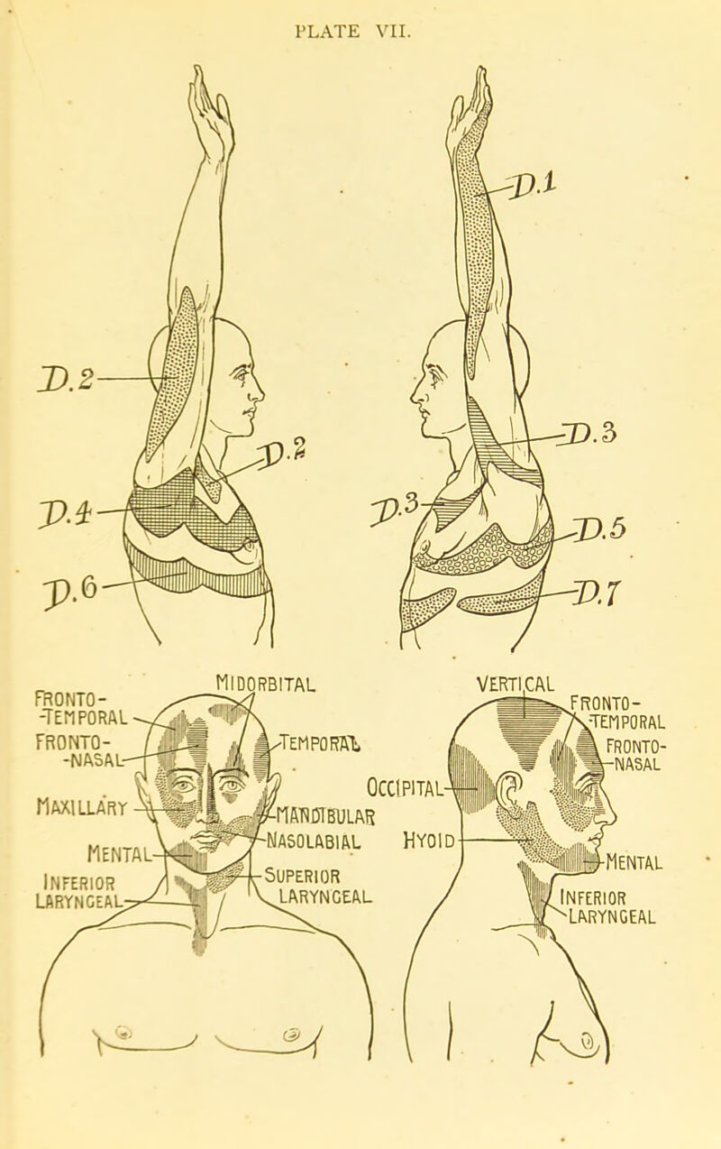 PRONTO- -TEMPORAL FR0NT0- -NASAL- MlDORBITAL Maxi llart ,-^ma'RDIbular VERTICAL FRONTO- TEMPORAL W Ohm fronto- W 1 m-NASAL Mental inferior LARYNGEAL