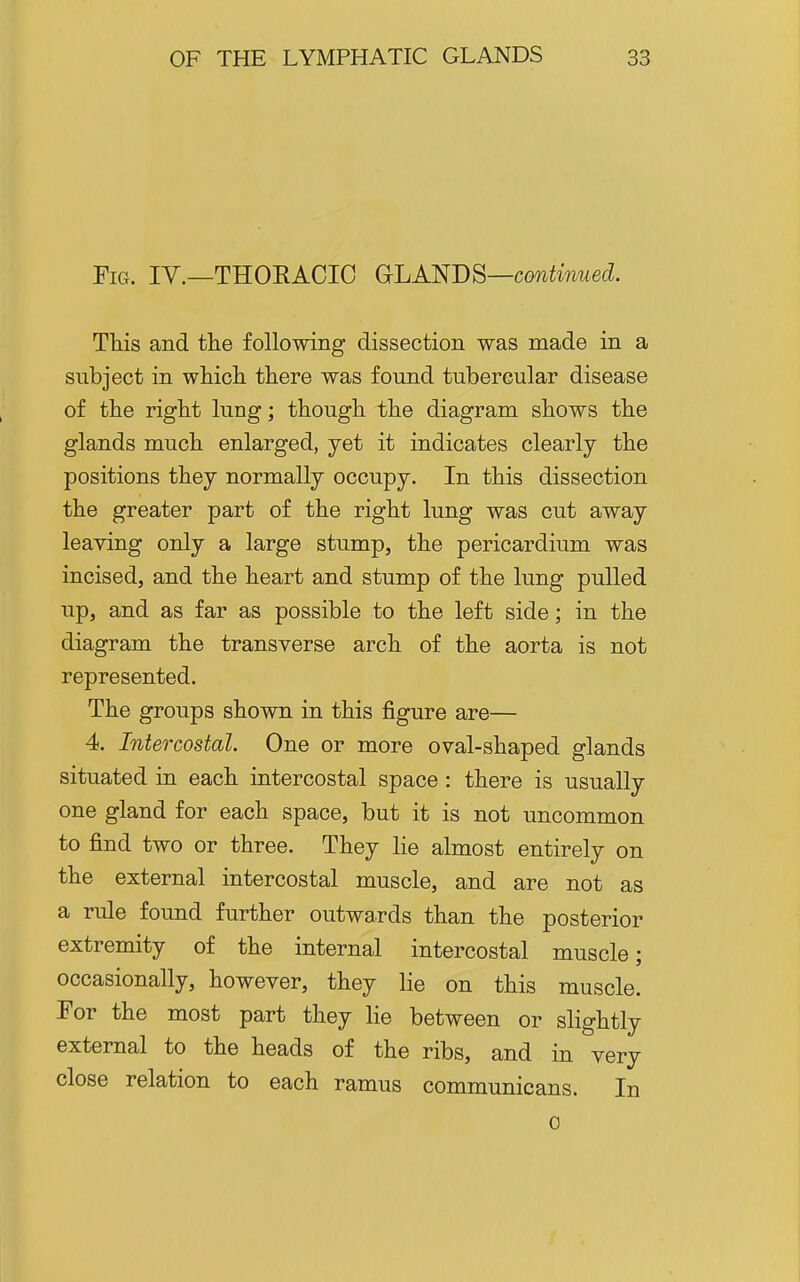 ¥iG. IV.—THOEACIC GcLA'NBS—continued. TMs and the following dissection was made in a subject in wliicli there was found tubercular disease of tlie rigbt lung; thougb tbe diagram sbows tbe glands mucb enlarged, yet it indicates clearly tbe positions tbey normally occupy. In this dissection the greater part of the right lung was cut away leaving only a large stump, the pericardium was incised, and the heart and stump of the lung pulled up, and as far as possible to the left side; in the diagram the transverse arch of the aorta is not represented. The groups shown in this figure are— 4. Intercostal. One or more oval-shaped glands situated in each intercostal space : there is usually one gland for each space, but it is not uncommon to find two or three. They lie almost entirely on the external intercostal muscle, and are not as a rule found further outwards than the posterior extremity of the internal intercostal muscle; occasionally, however, they lie on this muscle. For the most part they lie between or slightly external to the heads of the ribs, and in very close relation to each ramus communicans. In 0