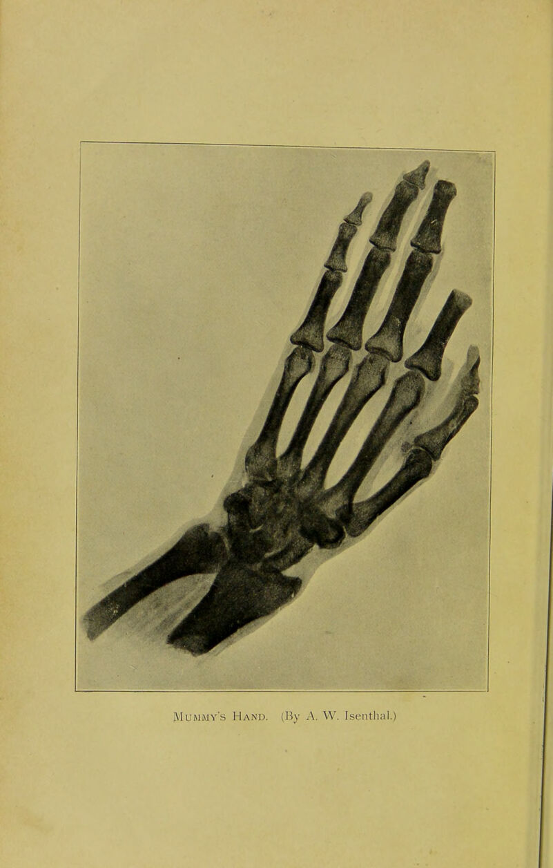 Mummy's Hand. (By A. W. tsenthal.)