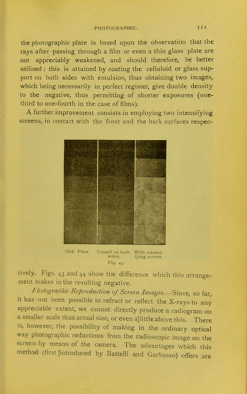 I 1 I the photographic plate is based upon the observation that the rays after passing through a film or even a thin glass plate are not appreciably weakened, and should therefore, be better utilised ; this is attained by coating the celluloid or glass sup- port on both sides with emulsion, thus obtaining two images, which being necessarily in perfect register, give double density to the negative, thus permitting of shorter exposures (one- third to one-fourth in the case of films). A further improvement consists in employing two intensifying screens, in contact with the front and the back surfaces respec- Ord. Plate Coated on both With intensi- sides. lying screen. fig- 43- tively. Figs. 43 and 44 show the difference which this arrange- ment makes in the resulting negative. Fhotographic Reproduction of Screen Images—Since, so far it has not been possible to refract or reflect the X-rays to any appreciable extent, we cannot directly produce a radiogram on a smaller scale than actual size, or even ajlittle above this. There is, however, the possibility of making in the ordinary optical way photographic reductions from the radioscopic image on the screen by means of the camera. The advantages which this method (first jintroduced by Battelli and Garbasso) offers are