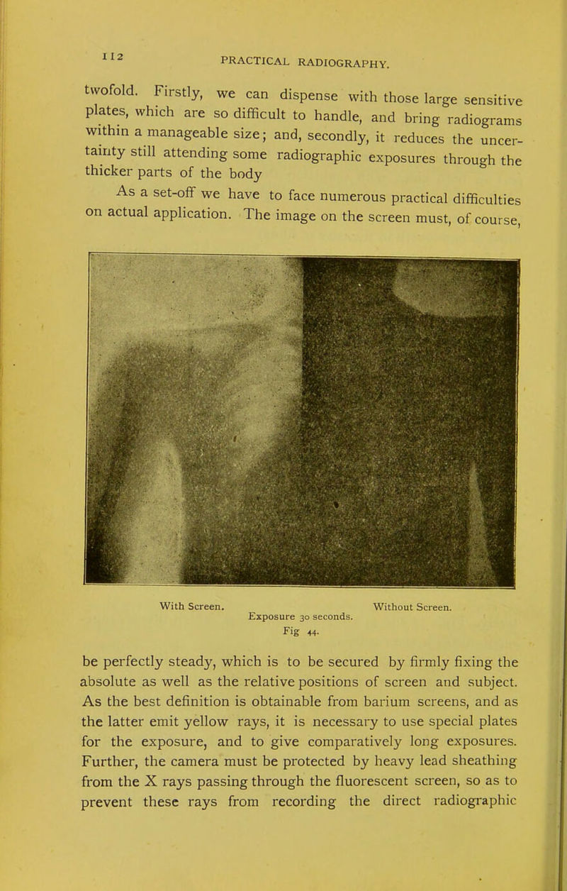 twofold. Firstly, we can dispense with those large sensitive plates, which are so difficult to handle, and bring radiograms within a manageable size; and, secondly, it reduces the uncer- tainty still attending some radiographic exposures through the thicker parts of the body As a set-off we have to face numerous practical difficulties on actual application. The image on the screen must, of course, With Screen. Exposure 30 seconds. Fig 44- Without Screen. be perfectly steady, which is to be secured by firmly fixing the absolute as well as the relative positions of screen and subject. As the best definition is obtainable from barium screens, and as the latter emit yellow rays, it is necessary to use special plates for the exposure, and to give comparatively long exposures. Further, the camera must be protected by heavy lead sheathing from the X rays passing through the fluorescent screen, so as to prevent these rays from recording the direct radiographic