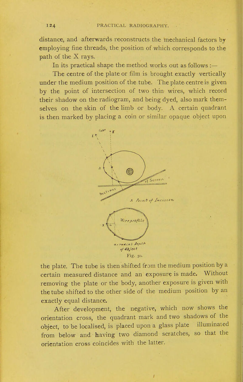 distance, and afterwards reconstructs the mechanical factors by employing fine threads, the position of which corresponds to the path of the X rays. In its practical shape the method works out as follows :— The centre of the plate or film is brought exactly vertically under the medium position of the tube. The plate centre is given by the point of intersection of two thin wires, which record their shadow on the radiogram, and being dyed, also mark them- selves on the skin of the limb or body. A certain quadrant is then marked by placing a coin or similar opaque object upon \ Fig. 5°- the plate. The tube is then shifted from the medium position by a certain measured distance and an exposure is made. Without removing the plate or the body, another exposure is given with the tube shifted to the other side of the medium position by an exactly equal distance. After development, the negative, which now shows the orientation cross, the quadrant mark and two shadows of the object, to be localised, is placed upon a glass plate illuminated from below and having two diamond scratches, so that the orientation cross coincides with the latter. /