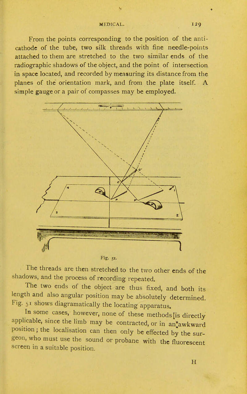 From the points corresponding to the position of the anti- cathode of the tube, two silk threads with fine needle-points attached to them are stretched to the two similar ends of the radiographic shadows of the object, and the point of intersection in space located, and recorded by measuring its distance from the planes of the orientation mark, and from the plate itself. A simple gauge or a pair of compasses may be employed. Fig. 51. The threads are then stretched to the two other ends of the shadows, and the process of recording repeated. The two ends of the object are thus fixed, and both its length and also angular position may be absolutely determined. Fig. 51 shows diagramatically the locating apparatus. In some cases, however, none of these methods [is directly applicable, since the limb may be contracted, or in ai^awkward position ; the localisation can then only be effected by the sur- geon, who must use the sound or probane with the fluorescent screen in a suitable position. II