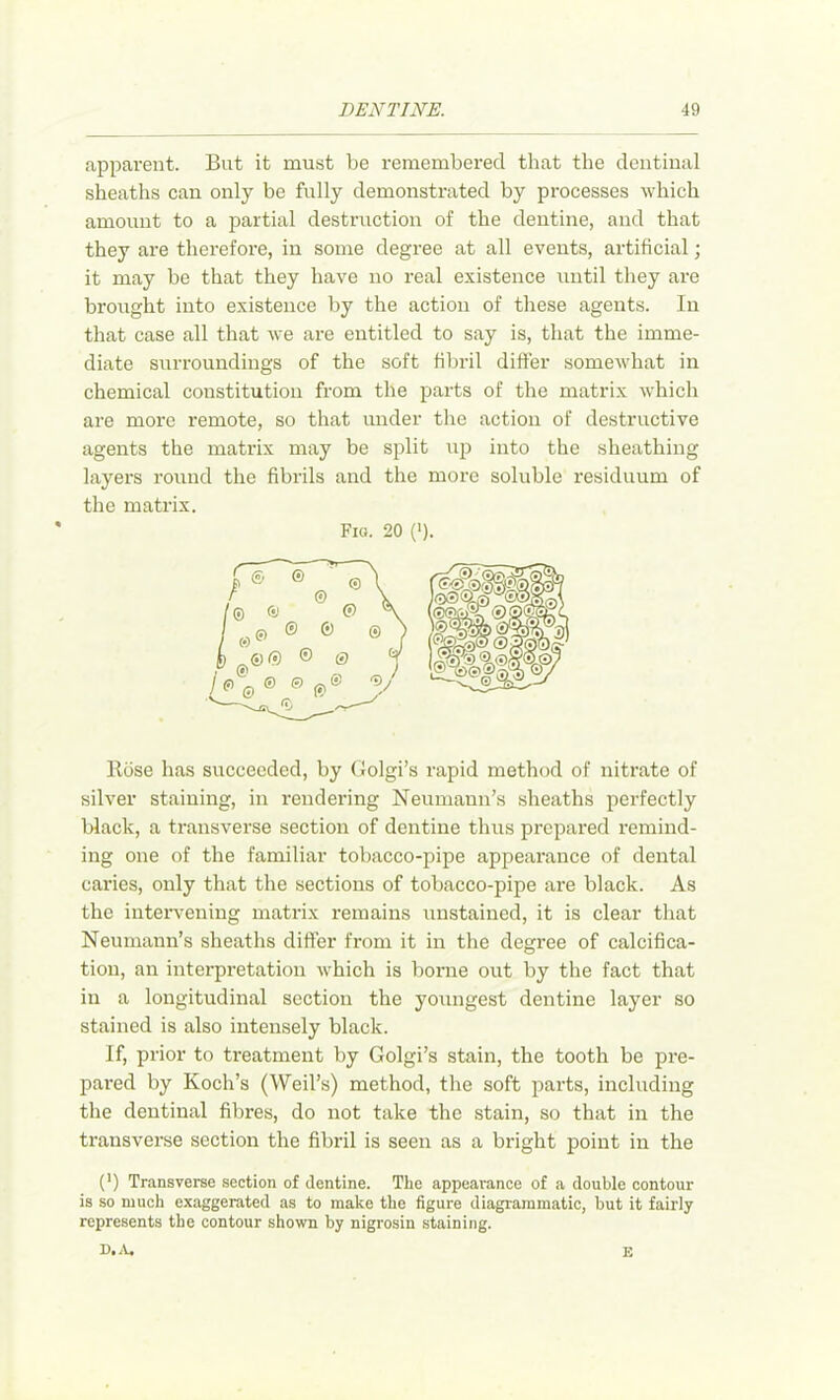 apparent. But it must be remembered that the deutiual sheaths can only be fully demonstrated by processes which amount to a partial destruction of the dentine, and that they are therefore, in some degree at all events, artificial; it may be that they have no real existence until they are brought into existence by the action of these agents. In that case all that we are entitled to say is, that the imme- diate surroundings of the soft fibril differ somewhat in chemical constitution from the parts of the matrix which are more remote, so that under the action of destructive agents the matrix may be split up into the sheathing layers round the fibrils and the more soluble residuum of the matrix. Fig. 20 (>). Rose has succeeded, by Golgi’s rapid method of nitrate of silver staining, in rendering Neumann’s sheaths perfectly black, a transverse section of dentine thus prepared remind- ing one of the familiar tobacco-pipe appearance of dental caries, only that the sections of tobacco-pipe are black. As the iuteiwening matrix remains unstained, it is clear that Neumann’s sheaths differ from it in the degree of calcifica- tion, an interpretation which is borne out by the fact that ill a longitudinal section the youngest dentine layer so stained is also intensely black. If, prior to treatment by Golgi’s stain, the tooth be pre- pared by Koch’s (Weil’s) method, the soft jDarts, including the dentinal fibres, do not take the stain, so that in the transverse section the fibril is seen as a bright point in the (') Transverse section of dentine. The appearance of a double contour is so much exaggerated as to make the figure diagrammatic, but it fairly represents the contour shown by nigrosin staining. D..V. E