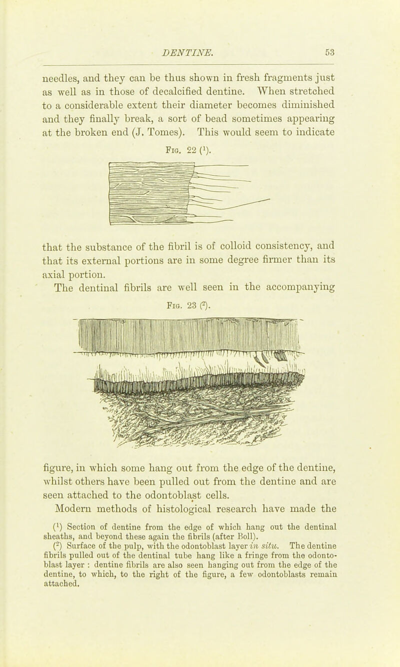 needles, and they can be thus shown in fresh fragments just as well as in those of decalcified dentine. When stretched to a considerable extent their diameter becomes diminished and they finally break, a sort of bead sometimes appearing at the broken end (J. Tomes). This would seem to indicate Fio. 22(‘). that the substance of the fibril is of colloid consistency, and that its external portions are in some degree firmer than its axial portion. The dentinal fibrils are well seen in the accompanying Fig. 23 0. figure, in which some hang out from the edge of the dentine, whilst others have been pulled out from the dentine and are seen attached to the odontoblast cells. Modern methods of histological research have made the (') Section of dentine from the edge of which hang out the dentinal sheaths, and beyond these again the fibrils (after Boll). (-) Surface of the pulp, with the odontoblast layer in situ. The dentine fibrils pulled out of the dentinal tube hang like a fringe from the odonto- blast layer ; dentine fibrils are also seen hanging out from the edge of the dentine, to which, to the right of the figure, a few odontoblasts remain attached.