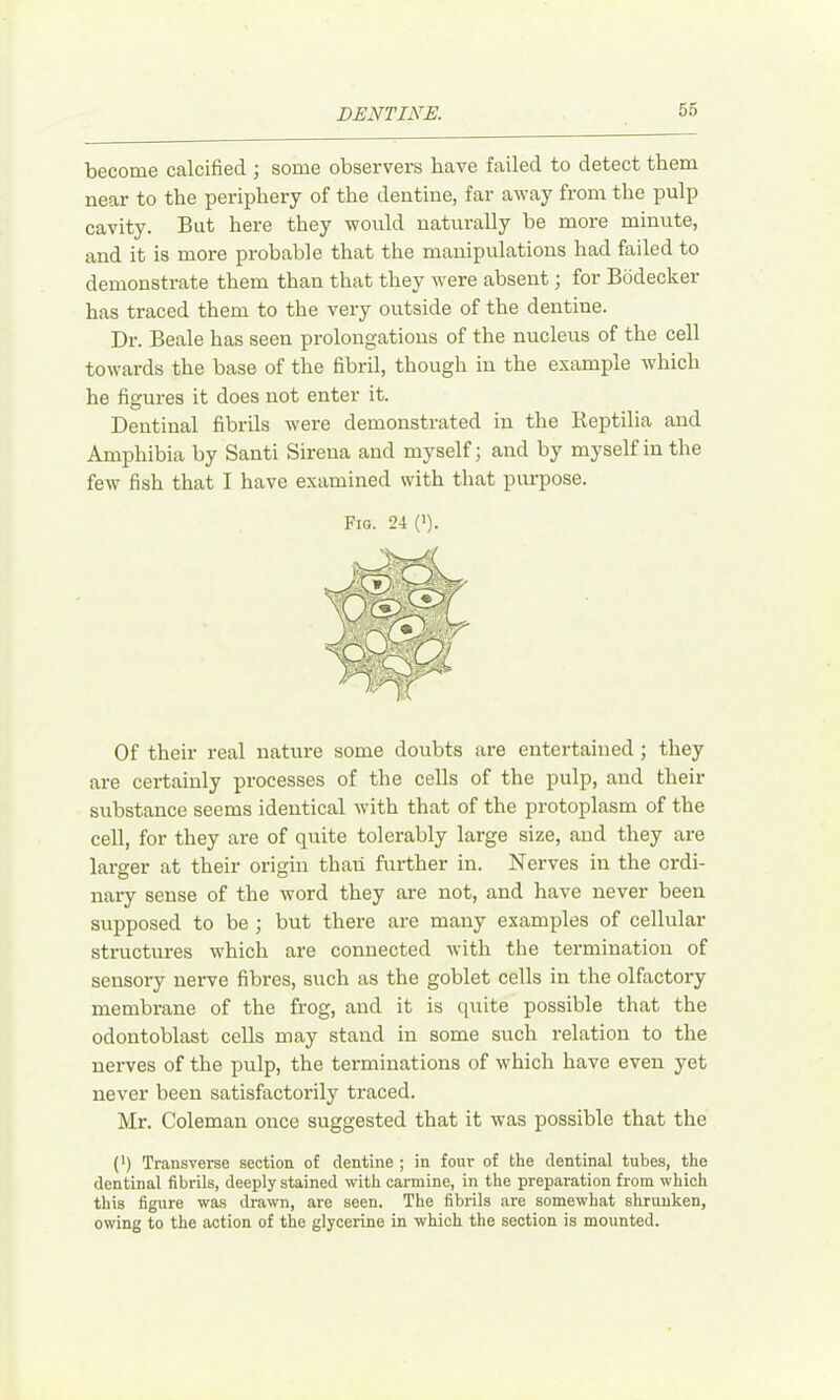 become calcified ; some observers have failed to detect them near to the periphery of the dentine, far away from the pulp cavity. But here they would naturally be more minute, and it is more probable that the manipulations had failed to demonstrate them than that they were absent; for Biidecker has traced them to the very outside of the dentine. Dr. Beale has seen prolongations of the nucleus of the cell towards the base of the fibril, though in the example which he figures it does not enter it. Dentinal fibrils were demonstrated in the lieptilia and Amphibia by Santi Sireua and myself; and by myself in the few fish that I have examined with that purpose. Fig. 24(>). Of their real nature some doubts are entertained ; they are certainly processes of the cells of the pulp, and their substance seems identical with that of the protoplasm of the cell, for they are of quite tolerably large size, and they are larger at their origin than further in. Nerves in the ordi- nary sense of the word they are not, and have never been supposed to be ; but there are many examples of cellular structures which are connected with the termination of sensory nerve fibres, such as the goblet cells in the olfactory membrane of the frog, and it is quite possible that the odontoblast cells may stand in some such relation to the nerves of the pulp, the terminations of which have even yet never been satisfactorily traced. Mr. Coleman once suggested that it was possible that the (') Transverse section of dentine ; in four of the dentinal tubes, the dentinal fibrils, deeply stained with carmine, in the preparation from which this figure was drawn, are seen. The fibrils are somewhat shrunken, owing to the action of the glycerine in which the section is mounted.