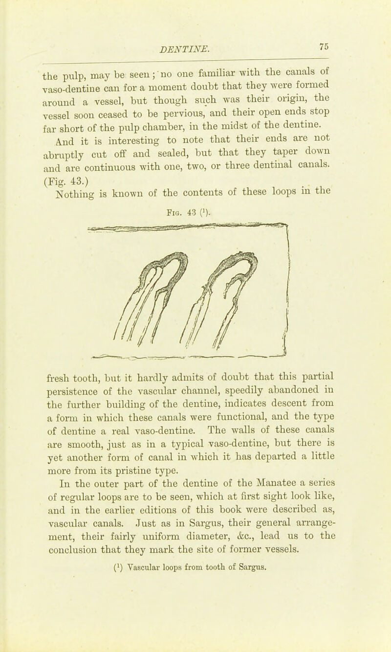 the pulp, may be seeu;' no one familiar with the canals of vaso-dentine can for a moment doubt that they were formed around a vessel, but though such was their origin, the vessel soon ceased to be pervious, and their open ends stop far short of the pulp chamber, in the midst of the dentine. A.nd it is interesting to note that their ends are not abniptly cut off and sealed, but that they taper down and are continuous with one, two, or three dentinal canals. (Fig. 43.) Nothing is known of the contents of these loops in the Fia. 43 (>). fresh tooth, but it hardly admits of doubt that this partial persistence of the vascular channel, speedily abandoned iu the further building of the dentine, indicates descent from a form in which these canals were functional, and the type of dentine a real vaso-dentine. The walls of these canals are smooth, just as in a typical vaso-dentine, but there is yet another form of canal in which it has departed a little more from its pristine type. In the outer part of the dentine of the Manatee a series of regular loops are to be seen, which at first sight look like, and in the earlier editions of this book were described as, vascular canals. Just as in Sargus, their general aiTange- ment, their fairly uniform diameter, &c., lead us to the conclusion that they mark the site of former vessels. (*) Vascular loops from tooth of Sargus.