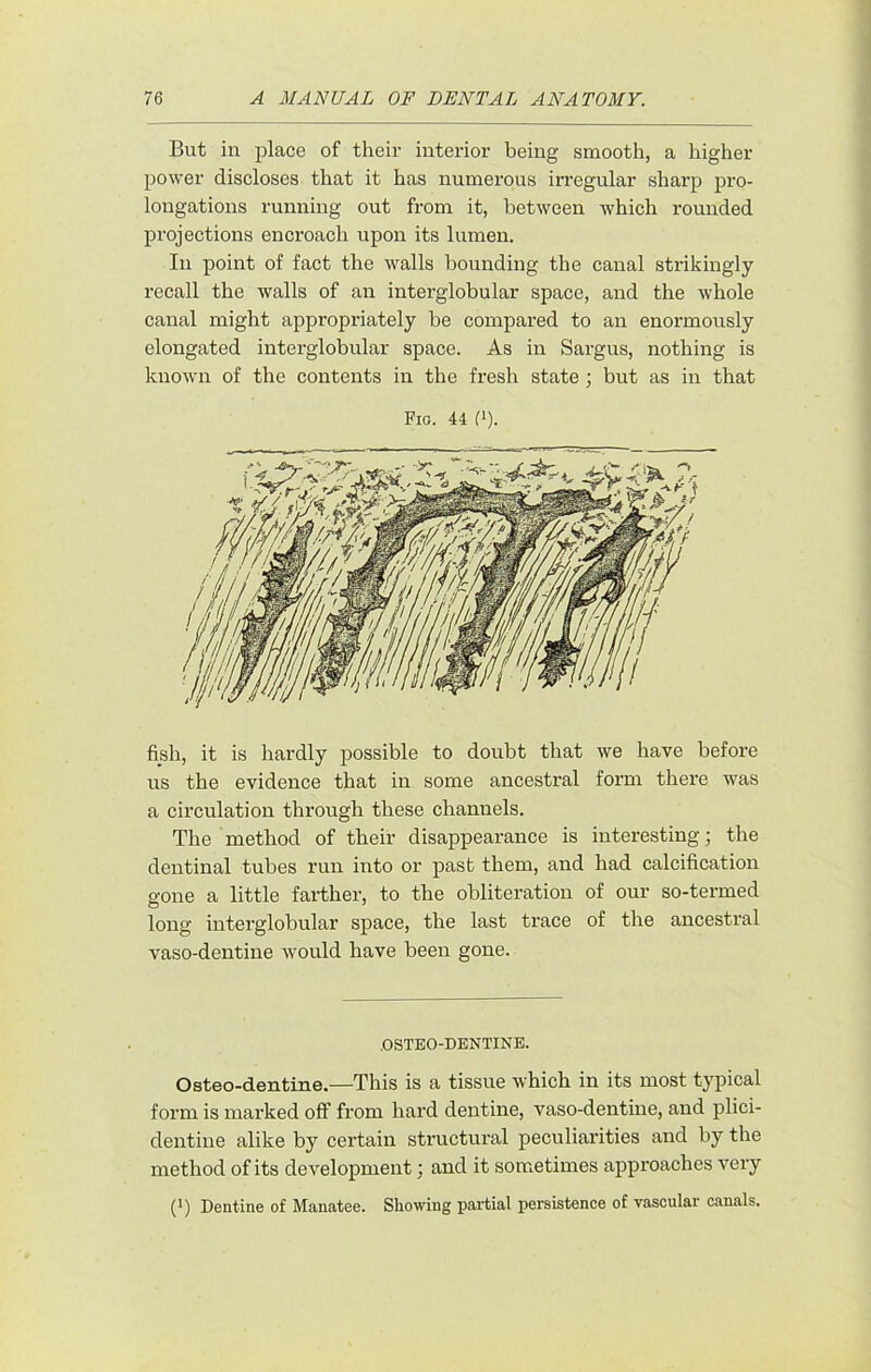 But in place of their interior being smooth, a higher power discloses that it has numerous irregular sharp pro- longations running out from it, between which rounded projections encroach upon its lumen. In point of fact the walls bounding the canal strikingly recall the walls of an interglobular space, and the whole canal might appropriately be compared to an enormously elongated interglobular space. As in Sargus, nothing is known of the contents in the fresh state ; but as in that Fig. 44 (>). fish, it is hardly possible to doubt that we have before us the evidence that in some ancestral form there was a circulation through these channels. The method of their disappearance is interesting; the dentinal tubes run into or past them, and had calcification gone a little farther, to the obliteration of our so-termed long interglobular space, the last trace of the ancestral vaso-dentine would have been gone. .OSTEO-DENTINE. Osteo-dentine.—This is a tissue which in its most typical form is marked off from hard dentine, vaso-dentine, and plici- dentine alike by certain structural peculiarities and by the method of its development; and it sometimes approaches very (*) Dentine of Manatee. Showing partial persistence of vascular canals.