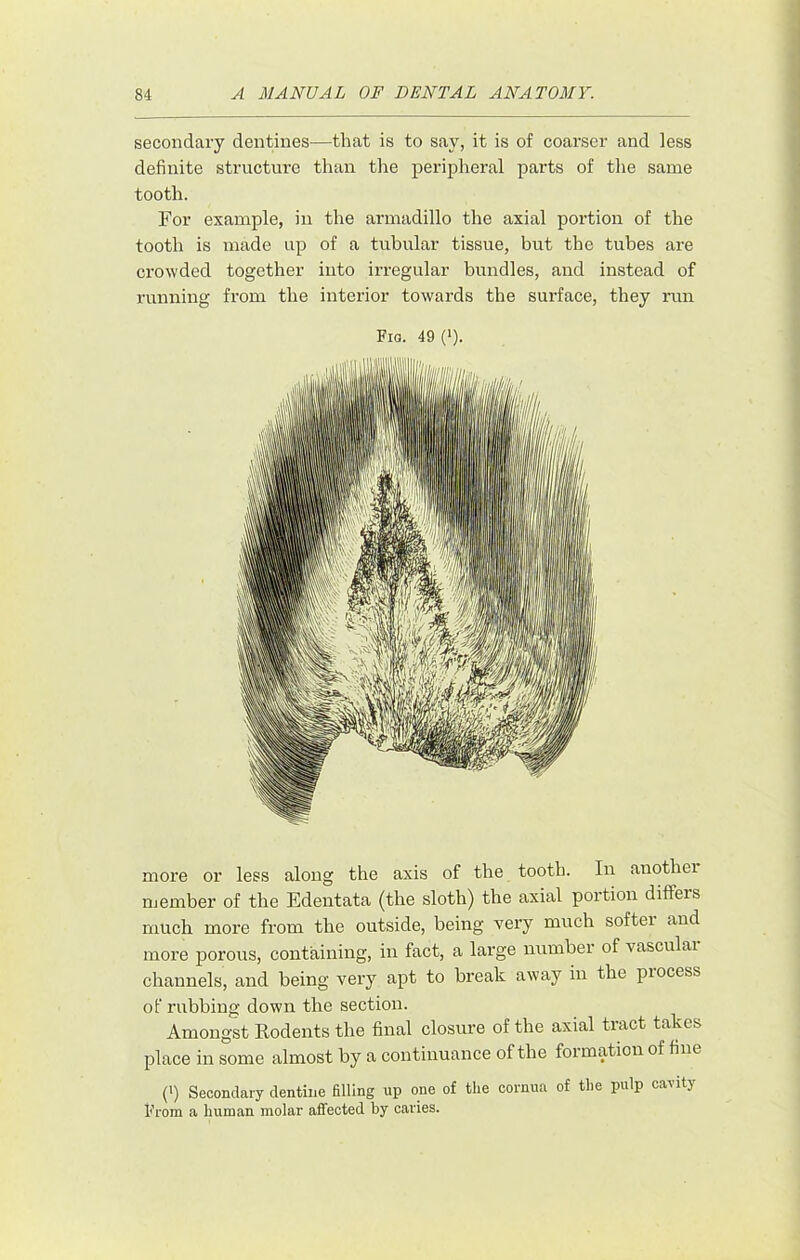 secondary dentines—that is to say, it is of coarser and less definite structure than the peripheral parts of the same tooth. For example, in the armadillo the axial portion of the tooth is made up of a tabular tissue, but the tubes are crowded together into irregular bundles, and instead of running from the interior towards the surface, they run Fig. 49 (*). more or less along the axis of the tooth. In anothei njember of the Edentata (the sloth) the axial portion differs much more from the outside, being very much softer and more porous, containing, in fact, a large number of vasculai channels, and being very apt to break away in the process of rubbing down the section. Amongst Rodents the final closure of the axial tract takes place in some almost by a continuance of the formation of fine (') Secondary dentine filling up one of the cornua of the pulp cavity From a human molar affected by caries.