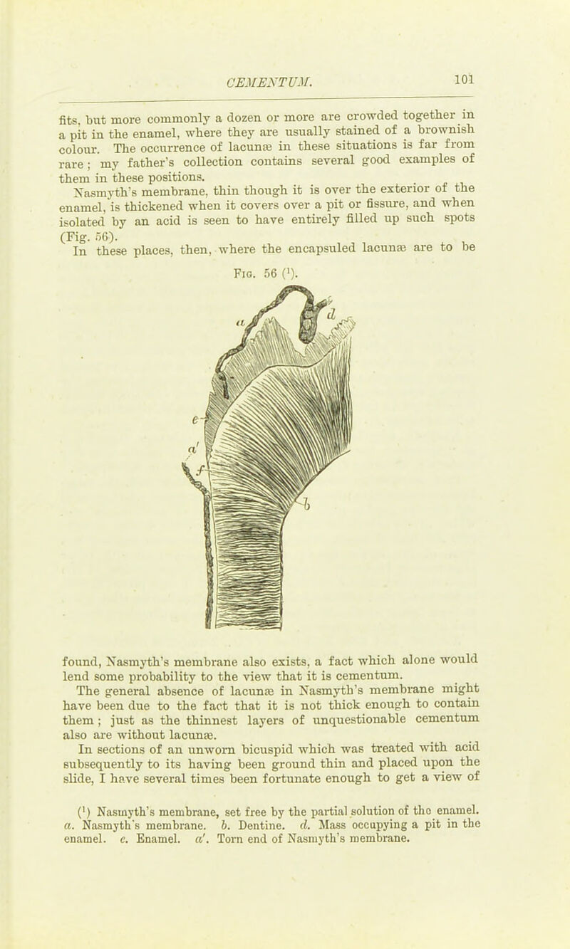 fits, blit more commonly a dozen or more are crowded together in a pit in the enamel, where they are usually stained of a brownish colour. The occurrence of lacunse in these situations is far from rare; my father’s collection contains several good examples of them in these positions. Xasmyth’s membrane, thin though it is over the exterior of the enamel, is thickened when it covers over a pit or fissure, and when an acid is seen to have entirely filled up such spots places, then, where the encapsuled lacunae are to be Fig. 56 ('). isolated by (Fig. 56). In these found, Xasmyth’s membrane also exists, a fact which alone would lend some probability to the view that it is cementum. The general absence of lacunie in Xasmyth’s membrane might have been due to the fact that it is not thick enough to contain them ; just as the thinnest layers of unquestionable cementum also are without lacume. In sections of an unworn bicuspid which was treated with acid subsequently to its having been ground thin and placed upon the slide, I have several times been fortunate enough to get a view of (') Nasmyth’s membrane, set free by the partial solution of tho enamel. a. Nasmyth's membrane, h. Dentine, d. Mass occupying a pit in the enamel, c. Enamel, a'. Torn end of Nasmyth’s membrane.