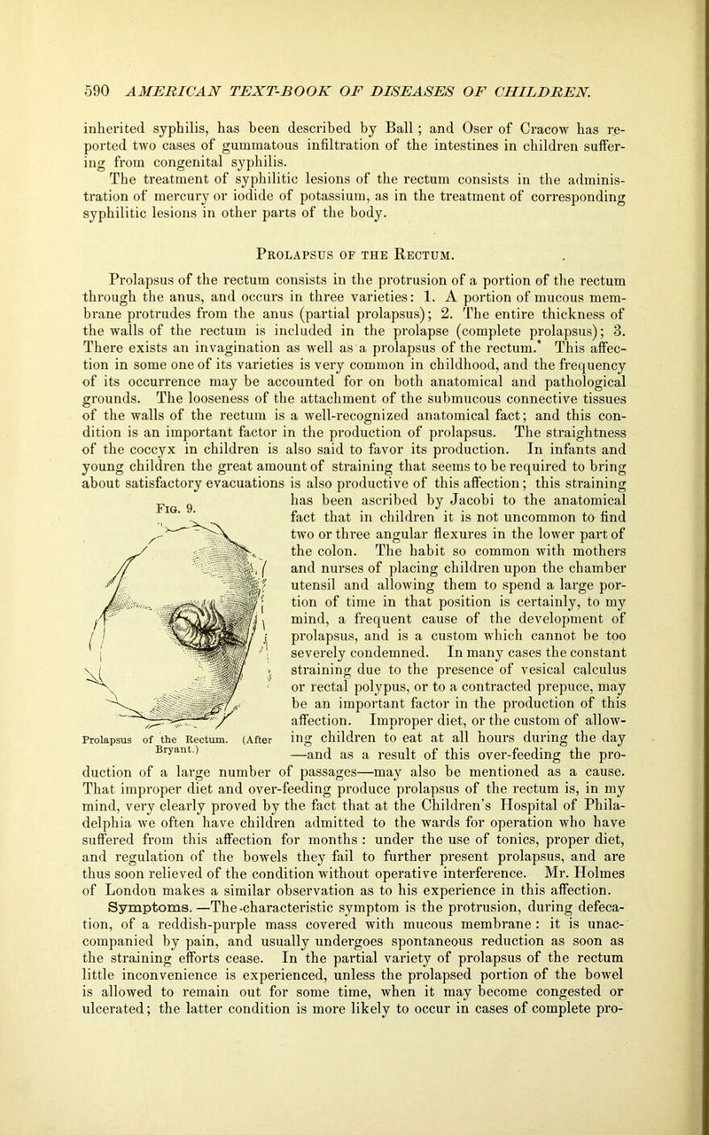 inherited syphilis, has been described by Ball; and Oser of Cracow has re- ported two cases of gummatous infiltration of the intestines in children suffer- ing from congenital syphilis. The treatment of syphilitic lesions of the rectum consists in the adminis- tration of mercury or iodide of potassium, as in the treatment of corresponding syphilitic lesions in other parts of the body. Prolapsus of the Rectum. Fig. 9. Pi'olapsus of the rectum consists in the protrusion of a portion of the rectum through the anus, and occurs in three varieties: 1. A portion of mucous mem- brane protrudes from the anus (partial prolapsus); 2. The entire thickness of the walls of the rectum is included in the prolapse (complete prolapsus); 3. There exists an invagination as well as a prolapsus of the rectum. This affec- tion in some one of its varieties is very common in childhood, and the frequency of its occurrence may be accounted for on both anatomical and pathological grounds. The looseness of the attachment of the submucous connective tissues of the walls of the rectum is a well-recognized anatomical fact; and this con- dition is an important factor in the production of prolapsus. The straightness of the coccyx in children is also said to favor its production. In infants and young children the great amount of straining that seems to be required to bring about satisfactory evacuations is also productive of this affection; this straining has been ascribed by Jacobi to the anatomical fact that in children it is not uncommon to find two or three angular flexures in the lower part of the colon. The habit so common with mothers and nurses of placing children upon the chamber utensil and allowing them to spend a large por- tion of time in that position is certainly, to my mind, a frequent cause of the development of prolapsus, and is a custom which cannot be too severely condemned. In many cases the constant straining due to the presence of vesical calculus or rectal polypus, or to a contracted prepuce, may be an important factor in the production of this affection. Improper diet, or the custom of allow- ing children to eat at all hours during the day —and as a result of this over-feeding the pro- duction of a large number of passages—may also be mentioned as a cause. That improper diet and over-feeding produce prolapsus of the rectum is, in my mind, very clearly proved by the fact that at the Children’s Hospital of Phila- delphia we often have children admitted to the wards for operation who have suffered from this affection for months : under the use of tonics, proper diet, and regulation of the bowels they fail to further present prolapsus, and are thus soon relieved of the condition without operative interference. Mr. Holmes of London makes a similar observation as to his experience in this affection. Symptoms.—The-characteristic symptom is the protrusion, during defeca- tion, of a reddish-purple mass covered with mucous membrane : it is unac- companied by pain, and usually undergoes spontaneous reduction as soon as the straining efforts cease. In the partial variety of prolapsus of the rectum little inconvenience is experienced, unless the prolapsed portion of the bowel is allowed to remain out for some time, when it may become congested or ulcerated; the latter condition is more likely to occur in cases of complete pro-