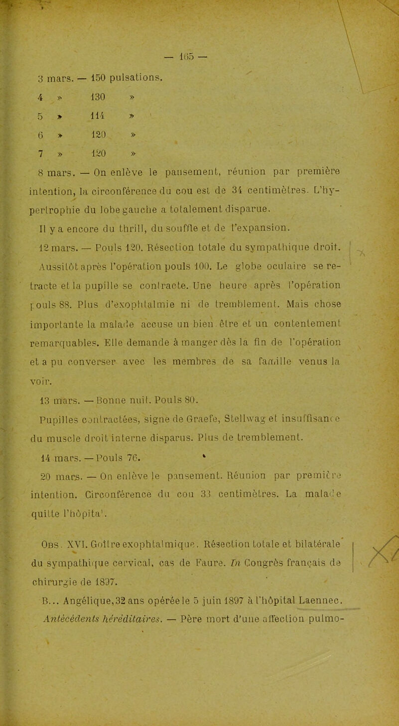 3 mars. — 150 pulsations. / 4 » 130 » 5 » 114 » 6 » 120 » 7 » 120 » 8 mars. — On enlève le pansement, réunion par première intention, la circonférence du cou est de 34 centimètres. L’hy- pertrophie du lobe gauche a totalement disparue. Il y a encore du thrill, du souffle et de l’expansion. 12mars. — Pouls 120. Résection totale du sympathique droit. Aussitôt après l’opération pouls 100. Le globe oculaire se re- tracte et la pupille se contracte. Une heure après l’opération [.ouïs 88. Plus d’exophtalmie ni de tremblement. Mais chose importante la malade accuse un bien être et un contentement remarquables. Elle demande à manger dès la fin de l’opération et a pu converser avec les membres de sa famille venus la voir. 13 mars. — Bonne nuit. Pouls 80. Pupilles contractées, signe de Graefe, Steltwaget insuffisance du muscle droit interne disparus. Plus de tremblement. 14 mars. — Pouls 76. ‘ 20 mars. — On enlève le pansement. Réunion par première intention. Circonférence du cou 33 centimètres. La malade quitte l’hôpita'. Obs. XVI. Goîlreexophtalmique. Résection totale et bilatérale du sympathique cervical, cas de Faure. Di Congrès français de chirurgie de 1807. B... Angélique, 32 ans opérée le 5 juin 1897 à l'hôpital Laennec. Antécédents héréditaires. — Père mort d’une atléction pulmo-