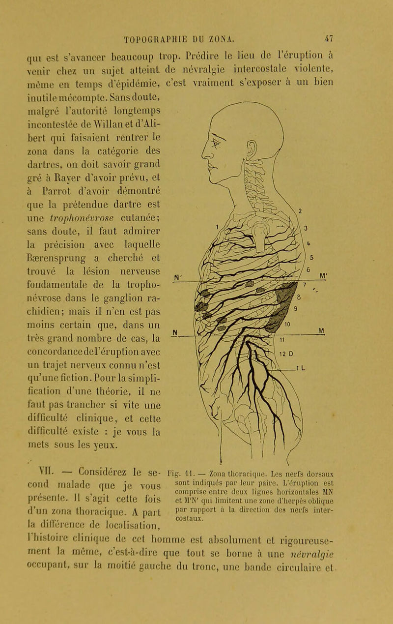 qui est s'avancer beaucoup trop. Prédire le lieu de l'éruption à venir riiez un sujet atteint de névralgie intercostale violente, même en temps d'épidémie, c'est vraiment s'exposer à un bien inutile mécompte. Sans doute, malgré l'autorité longtemps incontestée de Willan et d'Ali- bert qui faisaient rentrer le zona dans la catégorie des dartres, on doit savoir grand gré à Rayer d'avoir prévu, et à Parrot d'avoir démontré que la prétendue dartre est une trophonëvrose cutanée; sans doute, il faut admirer la précision avec laquelle Bserensprung a cherché et trouvé la lésion nerveuse fondamentale de la tropho- nëvrose dans le ganglion ra- chidien; mais il n'en est pas moins certain que, dans un très grand nombre de cas, la concordance del'éruplion avec un trajet nerveux connu n'est qu'une fiction. Pour la simpli- fication d'une théorie, il ne faut pas trancher si vite une difficulté clinique, et cette difficulté existe : je vous la mets sous les yeux. Ml. — Considérez le se- Fig. Il.— Zona thoracique. Les nerfs dorsaux cond malade que je vous sont indi(iu,5s Par leur Paire- L'éruption est présente. Il s'agit cette fois d'un zona thoracique. A part la différence de localisation, l'histoire clinique de cet homme est absolument cl rigoureuse- ment la même, c'est-à-dire que tout se borne à une névralgie occupant, sur la moitié gauche du tronc, une bande circulaire et comprise entre deux lignes horizontales MN et M'K' qui limitent, une zone d'herpès oblique par rapport à la direction des nerfs inter- costaux.