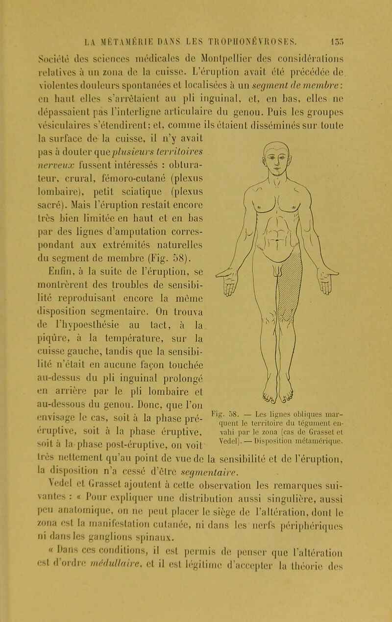 Société îles sciences médicales de Montpellier des considérations relatives à un zona de la cuisse. L'éruption avait été précédée de violentes douleurs spontanées et localisées à un segment de membre : en haut elles s'arrêtaient au pli inguinal, et, en bas, elles ne dépassaient pas l'interligne articulaire du genou. Puis les groupes vésiculaires s'étendirent : et, comme ils étaient disséminés sur toute la surl'ace de la cuisse, il n'y avait pas à douter queplusieurs territoires nerveux lussent intéressés : obtura- teur, crural, fémoro-culané (plexus lombaire), petit scialique (plexus sacré|. Mais l'éruption restait encore très bien limitée en haut et en bas par des lignes d'amputation corres- pondant aux extrémités naturelles du segment de membre (Fig. 58). Enfin, à la suite de l'éruption, se montrèrent des troubles de sensibi- lité reproduisant encore la même disposition segmentaire. On trouva de riiypoeslhésie au tact, à la piqûre, à la température, sur la cuisse gauche, tandis que la sensibi- lité n'était en aucune façon touchée au-dessus du pli inguinal prolongé en arrière par le pli lombaire cl au-dessous du genou. Donc, que l'on envisage le cas, soit à la phase pré- éruptive, soit à la phase éruptive, soit à la phase post-éruptive, on voit très nettement qu'au point de vue de la sensibilité et de l'éruption, la disposition n'a cessé d'être segmentaire. vedel et Grasset ajoutent à cette observation les remarques sui- vantes : <i Pour expliquer une distribution aussi singulière, aussi peu analomique, on ne peut placer le siège de l'altération, dont le zona est la manifestation cutanée, ni dans les nerfs périphériques ni dans les ganglions spinaux. « Dans ces conditions, il est permis de penser que l'altération est d'ordre médullaire, et il est légitime d'accepter la théorie des Fig. 58. — Les lignes obliques mar- quent le territoire du tégument en- vahi par li' zona (cas de Grassel el Vedel:. — Disposition métamérique.