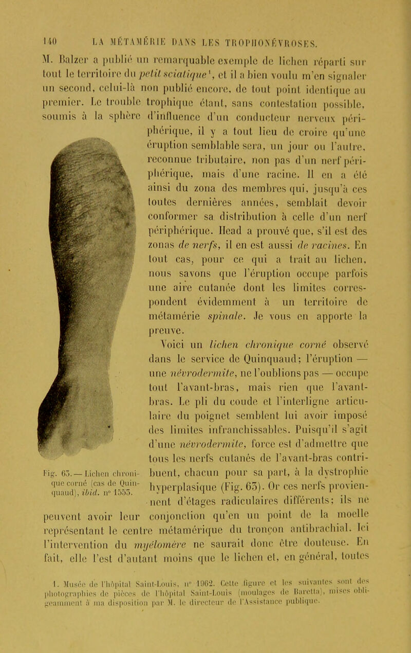 M. Balzer a publié mi remarquable exemple de lichen réparti sur tout le territoire du petit scialique1, et il a bien voulu m'en signaler un second, celui-là non publié encore, de tout point identique au premier. Le trouble trophique étant, sans contestation possible, soumis à la sphère d'influence d'un conducteur nerveux péri- phérique, il y a tout lieu de croire qu'une éruption semblable sera, un jour on l'autre, reconnut1 tributaire, non pas d'un nerf péri- phérique, mais d'une racine. 11 eu a élé ainsi du zona des membres ([ni, jusqu'à ces toutes dernières années, semblait devoir conformer sa distribution à celle d'un nerf périphérique, llead a prouvé que, s'il esl des zonas de nerfs, il en est aussi de racines. En tout cas, pour ce qui a trait au lichen, nous savons que l'éruption occupe parfois une aire cutanée dont les limites corres- pondent évidemment à un territoire de métamérie spinale. Je vous en apporte la preuve. Voici un lichen chronique corné observé dans le service de Quinquaud; l'éruption — une névrodermite, ne l'oublions pas — occupe tout l'avant-bras, mais rien que l'avant- bras. Le pli du coude et l'interligne articu- laire du poignet semblent lui avoir imposé des limites infranchissables. Puisqu'il s'agil d'une névrodermite, force est d'admettre que tous les nerfs cutanés de l'avant-bras contri- buent, chacun pour sa pari, à la dystrophie hyperplasique (Fig. 63). Or ces nerfs provien- nent d'étages radiculaires différents; ils né conjonction qu'en un point de la moelle eprésentant le centre métamérique du tronçon antibrachial. Ici l'intervention du mijélomère ne saurait donc être douteuse. En fait, elle l'est d'autant moins que le lichen et, en général, tontes W *   Fig. 63. — Lichen chroni- que corné cas de Quin- quaud), ibid. ii 1555. peu vent avoir leur r t. Musée de l'hôpital Saint-Louis, n 1062. Celte Ggure cl les suivantes sonl des photographies de pièces de l'hôpital Saint-Louis (moulages de Barctta), mises obli-