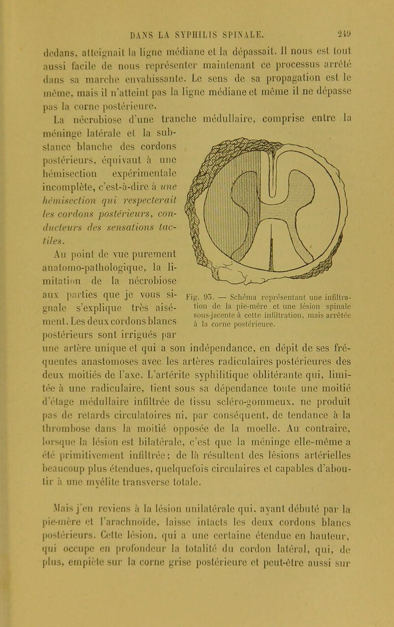 dedans, atteignait la ligne médiane el la dépassait. 11 nous est tout aussi facile de nous représenter maintenant ce processus arrêté dans sa marche envahissante. Le sens de sa propagation est le même, mais il n'atteint pas la ligne médiane et même il ne dépasse pas ta corne postérieure. La nécrobiose d'une tranche médullaire, comprise entre la méninge latérale et la sub- stance blanche des cordons postérieurs, équivaut à une hémisection expérimentale incomplète, c'est-à-dire h une hémisection qui respecterait les cordons postérieurs, con- ducteurs des sensations tac- tiles. Au point de vue purement anatomo-pathologiquc, la li- mitation de la nécrobiose aux parties que je VOUS si- Fig. 93. — Schéma représentant une infilira- gnale s'explique très aisé- tion de la pie-mère et une lésion spinale j . , sous-jacente à celle infiltration, mais arrêtée ment. Les deux cordons blancs à la corne postérieure, postérieurs sont irrigués par une artère unique et qui a son indépendance, en dépit de ses fré- quentes anastomoses avec les artères radiculaires postérieures des deux moitiés de l'axe. L'arlérite syphilitique oblitérante qui, limi- tée à une radiculaire, lient sous sa dépendance toute une moitié d'étage médullaire infiltrée de tissu scléro-gommeux, ne produit pas de relards circulatoires ni, par conséquent, de tendance à la thrombose dans la moitié opposée de la moelle. Au contraire, lorsque la lésion est bilatérale, c'est que la méninge elle-même a été primitivement infiltrée; de là résultent des lésions artérielles beaucoup plus étendues, quelquefois circulaires et capables d'abou- tir ii une myélite transverse totale. .Mais j'en reviens à la lésion unilatérale qui. ayant débuté par la pie-mère et l'arachnoïde, laisse intacts les deux cordons blancs postérieurs. Celte lésion, qui a une certaine étendue en hauteur, qui occupe en profondeur la totalité du cordon latéral, qui, de plus, empiète sur la corne grise postérieure et peut-être aussi sur