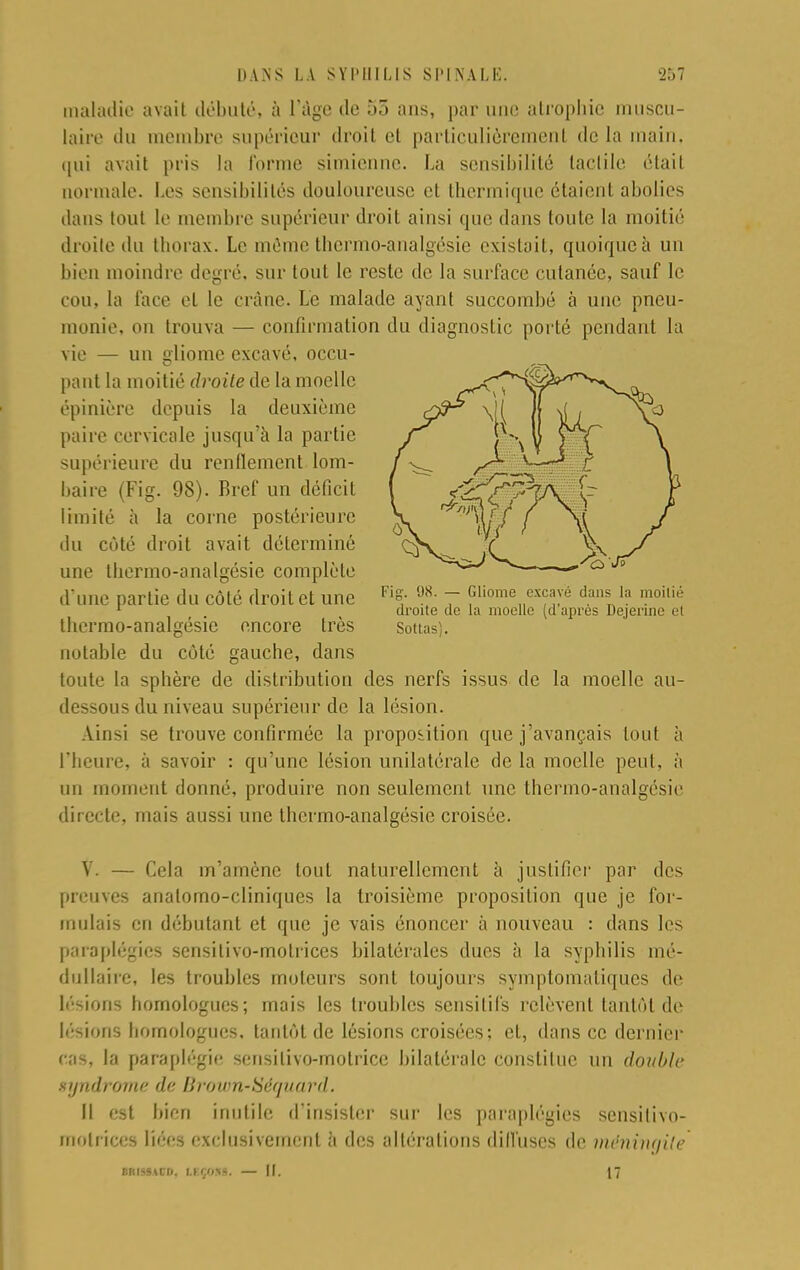 maladie avait débuté, à l'âge île ù5 ans, par une atrophie muscu- laire du membre supérieur droit et particulièrement de la main, qui avait pris la l'orme simienne. La sensibilité laelile était normale. Les sensibilités douloureuse et thermique étaient abolies dans tout Le membre supérieur droit ainsi que dans toute la moitié droite du thorax. Le même thermo-analgésie existait, quoique à un bien moindre degré, sur tout le reste de la surface cutanée, sauf le cou, la face et le crâne. Le malade ayant succombé à une pneu- monie, on trouva — confirmation du diagnostic porté pendant la vie — un Home excavé. occu- pant la moitié droite de la moelle épinière depuis la deuxième paire cervicale jusqu'à la partie supérieure du renflement lom- baire (Fig. 98). Bref un déficit limité à la corne postérieure du côté droit avait déterminé une thermo-analgésie complète d'une partie du côté droil et une Fi°- 98- 7 ?Uome *x™é dansJa moi,ié 1 . droite tic la moelle (d après Dejerinc el thermo-analgésie encore très Sottas). notable du côté gauche, dans toute la sphère de distribution des nerfs issus de la moelle au- dessous du niveau supérieur de la lésion. Ainsi se trouve confirmée la proposition que j'avançais tout à l'heure, à savoir : qu'une lésion unilatérale de la moelle peut, à un moment donné, produire non seulement une thermo-analgésie directe, mais aussi une thermo-analgésie croisée. V. — Cela m'amène tout naturellement à justifier par des preuves analomo-cliniques la troisième proposition que je for- mulais en débutant et que je vais énoncer à nouveau : dans les paraplégies sensilivo-motriecs bilatérales dues à la syphilis mé- dullaire, les troubles moteurs sont toujours symptomaliques de Lésions homologues; mais les troubles sensitifs relèvent tantôt de lésions homologues, tantôt de lésions croisées: el, dans ce dernier cas, la paraplégie scnsilivo-motrice bilatérale constitue un double syndrome de Brown-Séquard. Il est bien inutile d'insister sur les paraplégies sensilivo- motiiccs liées exclusivement à des altérations diffuses de méningite MtfUSD, LKÇOtê. — il. 17