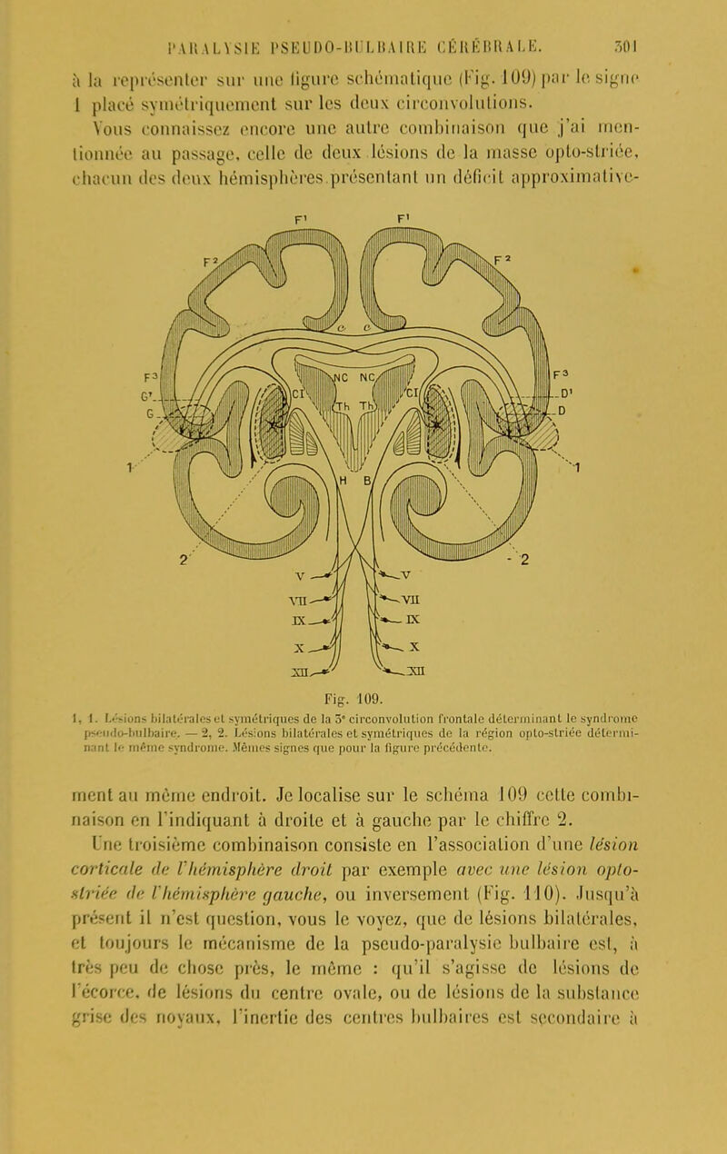 à la représenter sur une ligure schématique (Fig. 109) par le signe l placé symétriquement sur 1rs deux circonvolutions. Vous connaissez encore une autre combinaison que j'ai men- tionnée au passage, celle de deux lésions de la masse opto-striée, chacun des deux hémisphères.présentant un déficit approximative- F1 F' Fig. 109. 1, I. Lésions bilatérales et symétriques de la 5 circonvolution frontale déterminant le syndrome ps'-udo-lmlbaire. —2, 2. Lésions bilatérales et symétriques de la région opto-striée détermi- nant !<• mémo syndrome. .Mêmes signes que pour la figure précédente. ment au même endroit. Je localise sur le schéma 109 cette combi- naison en l'indiquant à droite et à gauche par le chiffre 2. Une troisième comhinaison consiste en l'association d'une lésion corticale de l'hémisphère droit par exemple avec une lésion opto- gtriée de l'hémisphère gauche, ou inversement (Fig. 110). Jusqu'à présent il n'est question, vous le voyez, que de lésions bilatérales, et toujours le mécanisme de la pseudo-paralysie bulbaire est, à très peu de chose près, le même : qu'il s'agisse de lésions de l'écoree. de lésions du centre ovale, ou de lésions de la substance grise des noyaux, l'inertie des centres bulbaires est secondaire à