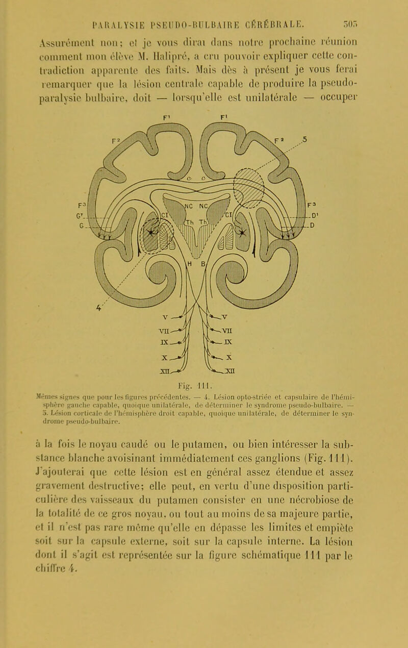 Assurément non; el je vous dirai dans notre prochaine l'éunion comment mon élève M. Halipré, a cru pouvoir expliquer cette con- tradiction apparente des faits. Mais dès à présent je vous ferai remarquer que la lésion centrale capable de produire la pseudo- paralysie bulbaire, doit — lorsqu'elle est unilatérale — occuper F' F' Fig. III. Hëmes signes que pour les figures précédentes. — 4. Lésion opto-strjée et capsulaire de l'hémi- sphère gauchi- capable, quoique unilatérale, de déterminer le syndrome pseudo-bulbaire. — 5. Lésion corticale de l'hémisphère droit capable, quoique unilatérale, de déterminer le syn- drome pseudo-bulbaire. à la fois le noyau caudé ou le putamen, ou bien intéresser la sub- stance blanche avoisinant immédiatement ces ganglions (Fig. 1 H ). J'ajouterai que cette lésion est en général assez étendue et assez gravement destructive; elle peut, en vertu d'une disposition parti- culière des vaisseaux du putamen consister en une nécrobiose de la totalité de ce gros noyau, ou tout au moins de sa majeure partie, et il n'est pas rare même qu'elle en dépasse les limites et empiète soit sur la capsule externe, soit sur la capsule interne. La lésion dont il s'agit est représentée sur la figure schématique 1 1 1 par le chiffre 4.