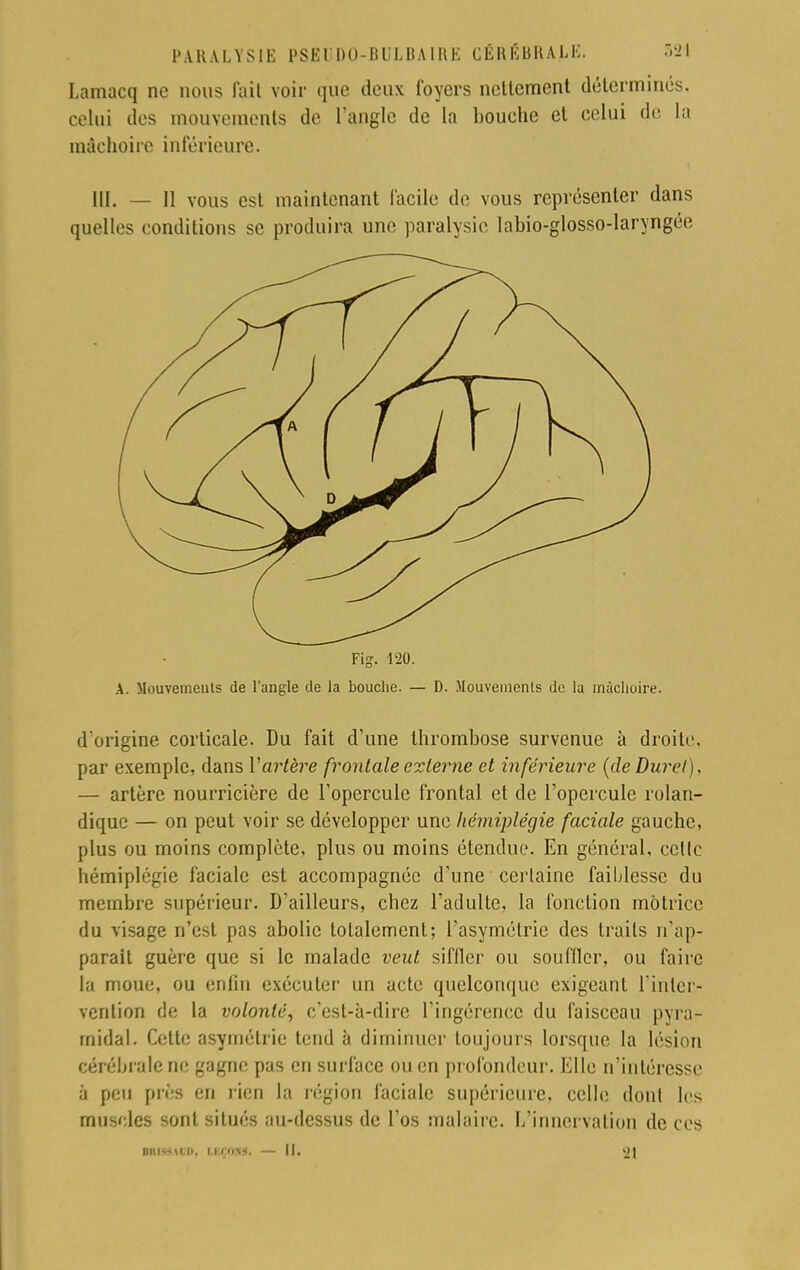 Lamacq ne nous fait voir que deux foyers ncltement déterminés, celui des mouvements de l'angle de la bouche et eelui de la mâchoire inférieure. III. — 11 vous est maintenant facile de vous représenter dans quelles conditions se produira une paralysie labio-glosso-laryngéc Yig. 120. A. Mouvements de l'angle de la bouche. — D. Mouvements de la mâchoire. d'origine corticale. Du fait d'une thrombose survenue à droite, par exemple, dans l'artère frontale externe et inférieure (deDurel), — artère nourricière de l'opercule frontal et de l'opercule rolan- dique — on peut voir se développer une hémiplégie faciale gauche, plus ou moins complète, plus ou moins étendue. En général, celle hémiplégie faciale est accompagnée d'une certaine faiblesse du membre supérieur. D'ailleurs, chez l'adulte, la fonction motrice du visage n'est pas abolie totalement; l'asymétrie des traits n'ap- parait guère que si le malade veut siffler ou souffler, ou faire la moue, ou enfui exécuter un acte quelconque exigeant l'inter- vention de la volonté, c'est-à-dire l'ingérence du faisceau pvra- midal. Cette asymétrie tend à diminuer toujours lorsque la lésion cérébrale ne gagne pas en surface ou en profondeur. Elle n'intéresse à peu près en rien la région faciale supérieure, celle dont les muscles sont situés au-dessus de l'os malaire. L'innervation de ces