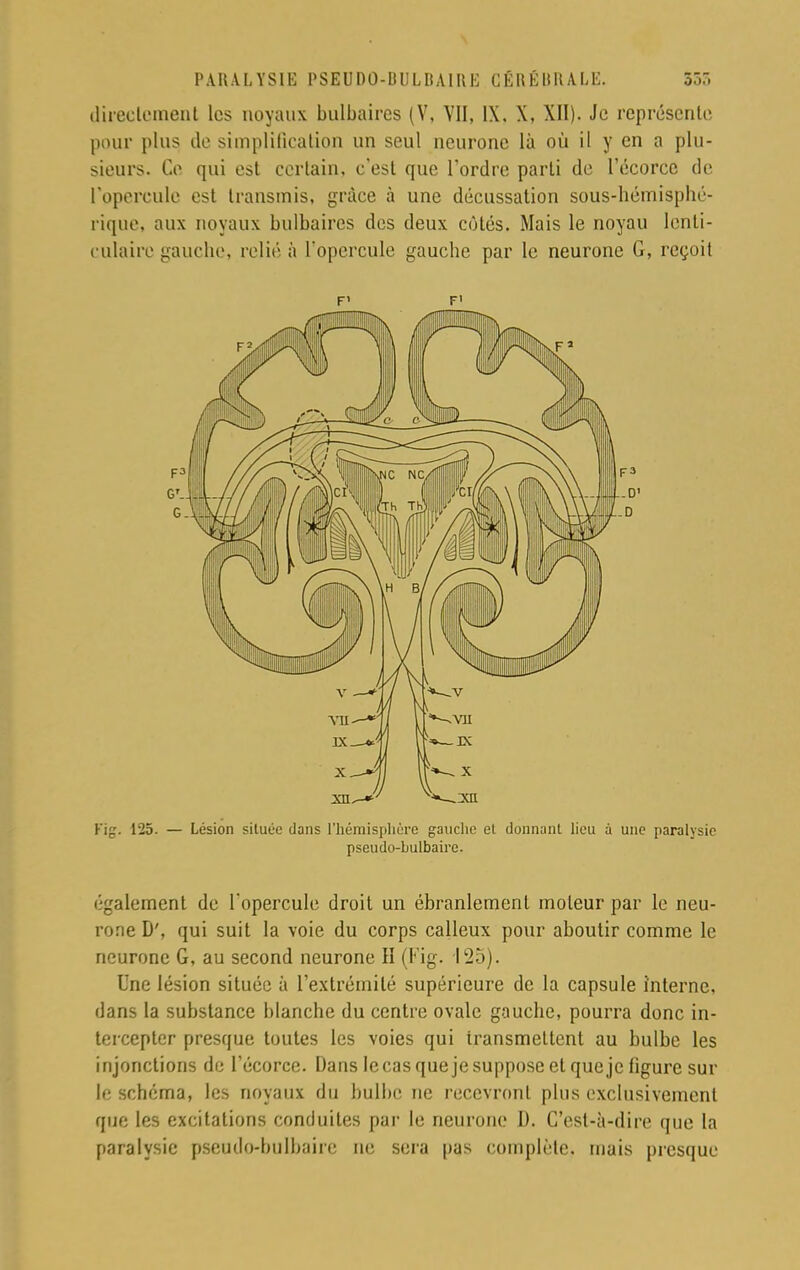 direcloment les noyaux bulbaires (V, VII, IX. X, XII). Je représente pour plus de simplification un seul neurone là où il y en a plu- sieurs. Ce qui est certain, c'est que l'ordre parti de l'écorce de l'opercule est transmis, grâce à une décussation sous-hémisphé- rique, aux noyaux bulbaires des deux côtés. Mais le noyau lenti- culaire gauche, relié à l'opercule gauche par le neurone G, reçoit F1 F' Fîg. 125. — Lésion située dans L'hémisphère gauclie el donnant lieu a une paralysie pseudo-bulbaire. également de l'opercule droit un ébranlement moteur par le neu- rone D', qui suit la voie du corps calleux pour aboutir comme le neurone G, au second neurone II (Fig. 125). Une lésion située à l'extrémité supérieure de la capsule interne, dans la substance blanche du centre ovale gauche, pourra donc in- tercepter presque toutes les voies qui transmettent au bulbe les injonctions de l'écorce. Dans lecas que je suppose et que je figure sur le schéma, les noyaux du bulbe ne recevront plus exclusivement que les excitations conduites par le neurone D. C'est-à-dire que la paralysie pseudo-bulbaire ne sera pas complète, mais presque