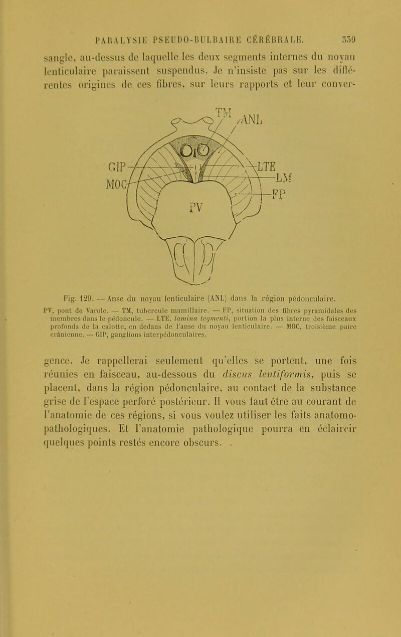 sangle, au-dessus de laquelle les deux segments internes du noyau Lenticulaire paraissent suspendus. Je n'insiste pas sur les diflé- rentes origines de ees libres, sur leurs rapports et leur conver- Fig. 129.—Anse du noyau lenticulaire (ANL) dans la région pédonculaire. PV, pont de Varolo. — TM, tubercule mamillaire. — FP. situation des fibres pyramidales des membres dans le pédoncule. — LTE, lamina tegmenti, portion la plus interne des faisceaux profonds de la calotte, en dedans de l'anse du noyau lenticulaire. — MOC, troisième paire crânienne. —G1P, ganglions interpédonculaires. gence. Je rappellerai seulement qu'elles se portent, une fois réunies en faisceau, au-dessous du disais lentiformis, puis se placent, dans la région pédonculaire, au contact de la substance grise de l'espace perforé postérieur. 11 vous faut être au courant de l'anatomic de ces régions, si vous voulez utiliser les faits analomo- patbologiques. El l'anatomie patbologique pourra en éclaircir quelques points restés encore obscurs. .