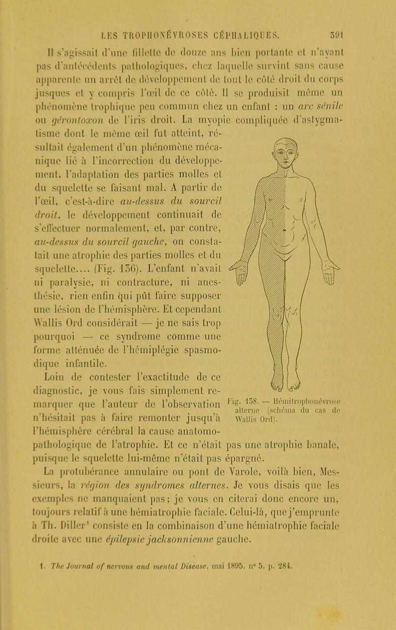 Il s'agissail d'une fillette de douze ans bien portante et n'ayant pas d'antécédents pathologiques, chez laquelle survint sans cause apparente an arrêt de développement de tout le côté droit du corps jusques et y compris l'œil de ce côté. 11 se produisit même un phénomène trophique peu commun chez un enfant : un arc sénile ou gérontox&n de l'iris droit. La myopie compliquée d'aslygma- tisme dont le même œil fut atteint, ré- sultait également d'un phénomène méca- nique lié à l'incorrection du développe- ment, l'adaptation des parties molles cl du squelette se faisant mal. A partir de l'œil, c'est-à-dire au-dessus du sourcil droit, le développement continuait de s'effectuer normalement, et, par contre, au-dessus du sourcil gauche, on consta- tait une atrophie des parties molles et du squelette.... (Fig. 15G). L'enfant n'avait ni paralysie, ni contracture, ni ancs- thesie, rien enfin qui pût faire supposer une lésion de l'hémisphère. Et cependant Wallis Ord considérait — je ne sais trop pourquoi — ce syndrome comme une forme atténuée de l'hémiplégie spasmo- dique infantile. Loin de contester l'exactitude de ce diagnostic, je vous fais simplement re- marquer que l'auteur de l'observation - Hémitrophonénwe . . 1 alterne (schéma du cas de n'hésitait pas à faire remonter jusqu'à Waliis Ord). l'hémisphère cérébral la cause anatomo- patbologique de l'atrophie. Et ce n'était pas une atrophie banale, puisque le squelette lui-même n'était pas épargné. La protubérance annulaire ou pont de Yarole, voilà bien, Mes- sieurs, la région des syndromes alternes. Je vous disais que les exemples ne manquaient pas; je vous en citerai donc encore un. tou jours relatif à une hémialrophic faciale. Celui-là, que j'emprunte à Th. Diller1 consiste en la combinaison d'une hémialrophic faciale droite avec une épilepsie jacksonnienne gauche.