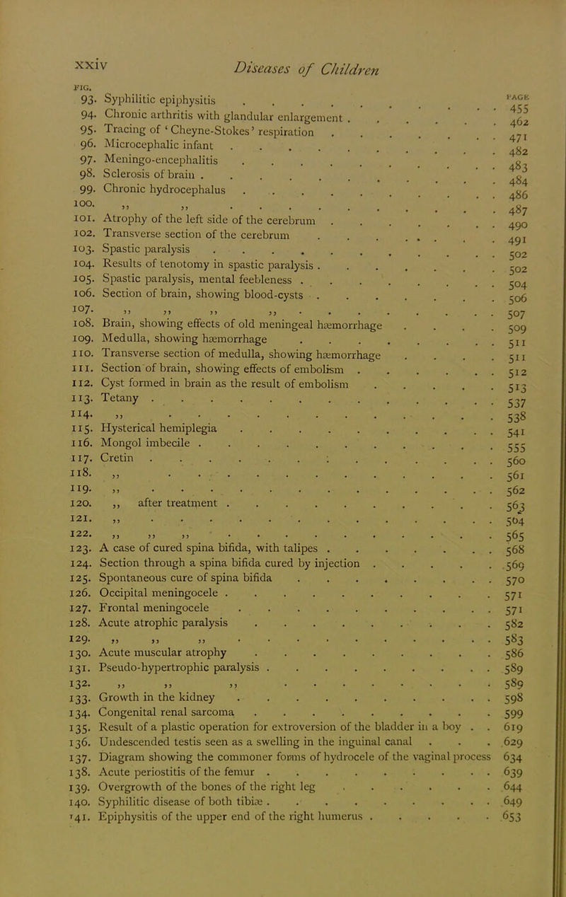 FIG. 93- 94. 95. 96. 97- 98. 99- 100. 101. 102. 103. 104. 105. 106. 107. 108. 109. no. 111. 112. 113. 114. 115. 116. 117. 118. 119. 120. 121. 122. 123. 124. 125. 126. 127. 128. 129. 130. 131. 132. 133. 134. 135. 136. 137. 138. 139. 140. T4I. Syphilitic epiphysitis .... Chronic arthritis with glandular enlargement Tracing of ‘ Cheyne-Stokes’ respiration Microcephalic infant .... Meningo-encephalitis .... Sclerosis of brain ..... Chronic hydrocephalus .... 5> >) .... Atrophy of the left side of the cerebrum . Transverse section of the cerebrum Spastic paralysis ..... Results of tenotomy in spastic paralysis . Spastic paralysis, mental feebleness . Section of brain, showing blood-cysts . Brain, showing effects of old meningeal haemorrhage Medulla, showing haemorrhage Transverse section of medulla, showing htemorrhage Section of brain, showing effects of embolism . Cyst formed in brain as the result of embolism Tetany ........ Hysterical hemiplegia Mongol imbecile . Cretin after treatment A case of cured spina bifida, with talipes . Section through a spina bifida cured by injection Spontaneous cure of spina bifida Occipital meningocele ..... Frontal meningocele ..... Acute atrophic paralysis .... Acute muscular atrophy Pseudo-hypertrophic paralysis Growth in the kidney ..... Congenital renal sarcoma ..... Result of a plastic operation for e.xtroversion of the bladder Undescended testis seen as a swelling in the inguinal canal Diagram showing the commoner foimis of hydrocele of the Acute periostitis of the femur ..... Overgrowth of the bones of the right leg Syphilitic disease of both tibL'e ..... Epiphysitis of the upper end of the right humerus . m a boy . aginal proces I'AGB 455 462 471 482 483 484 486 487 490 491 502 502 504 506 507 509 511 511 512 513 537 538 541 555 560 561 562 563 5t^4 565 568 569 570 571 571 582 583 586 589 589 598 599 619 629 634 639 644 .649 653