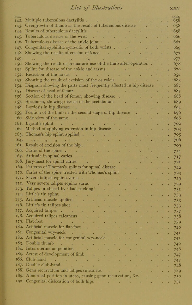 FIG. 142. 143- 144. 145. 146. 147. 148. 149. 15c. 151. 152. 153- 154. 155- 156. 157- 158. IS9- 160. 161. 162. 163. 164. 165. 166. 167. 168. 169. 170. 171. 172. 173- 174. 175- 176. 177. 178. 179. 180. 181. 182. 183. 184. 185. 1^86. 187. 188. 189. 190. Multiple tuberculous dactylitis ..... Overgrowth of thumb as the result of tuberculous disease Results of tuberculous dactylitis .... Tuberculous disease of the wrist . . . . . Tuberculous disease of the ankle joint ■ . Congenital syphilitic synovitis of both wrists . * Showing the results of erasion of knee > > 5 5 3 ) 33 Showing the result of premature use of the limb after operation . Splint for disease of the ankle and tarsus .... Resection of the tarsus ........ Showing the result of excision of the os calcis . . 1 . Diagram showing the parts most frequently affected in hip disease Disease of head of femur ....... Section of the head of femur, showing disease .... Specimen, showing disease of the acetabulum Lordosis in hip disease ........ Position of the limb in the second stage of hip disease Side view of the same ........ Bryant’s splint ......... Method of applying extension in hip disease .... Thomas’s hip splint applied ....... 3 3 3 3 •••••••• • Result of excision of the hip ....... Caries of the spine ......... Attitude in spinal caries ....... Jury-mast for spinal caries ....... Patterns of Thomas’s splints for spinal disease Caries of the spine treated with Thomas’s splint Severe talipes equino-varus ....... Very severe talipes equino-varus ...... Talipes produced by ‘ bad packing’ ..... Little’s tin splint ......... Artificial muscle applied ....... Little’s tin talipes shoe ........ Acquired talipes ......... Acquired talipes calcaneus ....... Flat-foot .......... Artificial muscle for flat-foot ....... Congenital wry-neck ........ Artificial muscle for congenital wry-neck ..... Double thumb ......... Intra-uterine amputation ....... Arrest of development of limb ...... Club-hand .......... Double club-hand ........ Genu recurvatum and talipes calcaneus ..... Abnormal position in utero, causing genu recurvatum, (.Krc. Congenital dislocation of both hips ...... PAGE 658 658 658 666 667 669 677 677 678 679 652 683 687 687 688 689 694 696 696 702 703 705 706 ■709 714 717 721 722 723 729 729 731 733 733 733 737 738 739 740 741 742 746 746 747 747 748 749 750 751