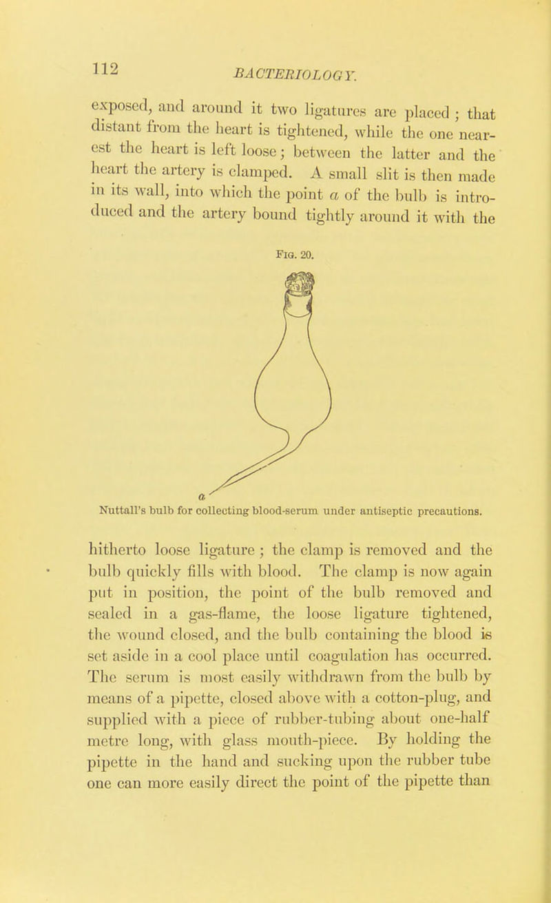 exposed, and around it two ligatures arc placed ; that distant from the heart is tightened, while the one near- est the heart is left loose; between the latter and the heart the artery is clamped. A small slit is then made in its wall, into which the point a of the bulb is intro- duced and the artery bound tightly around it with the Fig. 20. Nuttall's bulb for collecting blood-serum under antiseptic precautions. hitherto loose ligature ; the clamp is removed and the bulb quickly fills with blood. The clamp is now again put in position, the point of the bulb removed and sealed in a gas-flame, the loose ligature tightened, the wound closed, and the bulb containing the blood is set aside in a cool place until coagulation has occurred. The serum is most easily withdrawn from the bulb by means of a pipette, closed above with a cotton-plug, and supplied with a piece of rubber-tubing about one-half metre long, with glass mouth-piece. By holding the pipette in the hand and sucking upon the rubber tube one can more easily direct the point of the pipette than