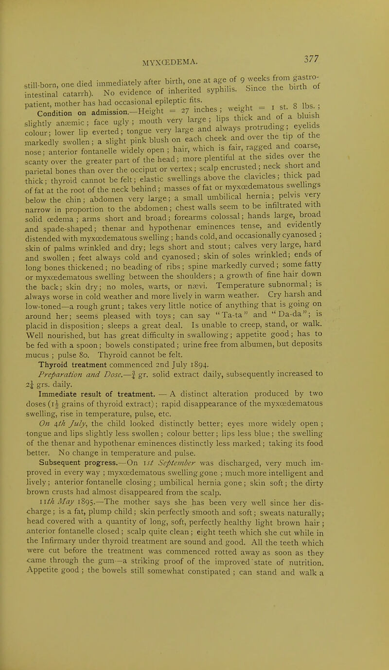 still-born, one died immediately after birth, one at age of 9^*^#£^ intestinal catarrh). No evidence of inherited syph.hs. Since the bath patient, mother has had occasional epileptic fits. Condition on admission.-Height = 27 inches ; weight - 1 A ^ slightly anemic; face ugly; mouth very large; hps th.ck and o a blu sh cofour; lower lip everted; tongue very large and ^ P«)trud^ng, ey.I ds markedly swollen; a slight pink blush on each cheek and over htip o^the nose: anterior fontanelle widely open ; hair, which ». fair, ragged d coa se scanty over the greater part of the head; more plentiful at the sides over 1he parietal bones than over the occiput or vertex; scalp encrusted; neck shoi t and thick; thyroid cannot be felt; elastic swellings above the clavicles; thick pad of fat at the root of the neck behind; masses of fat or myxedematous swellings below the chin; abdomen very large; a small umbilical hernia; pelvis very narrow in proportion to the abdomen; chest walls seem to be infiltrated with solid oedema; arms short and broad; forearms colossal; hands large, broad and spade-shaped; thenar and hypothenar eminences tense, and evidently distended with myxoedematous swelling; hands cold, and occasionally cyanosed ; skin of palms wrinkled and dry; legs short and stout; calves very large, hard and swollen ; feet always cold and cyanosed; skin of soles wrinkled; ends of long bones thickened; no beading of ribs ; spine markedly curved; some fatty or myxoedematous swelling between the shoulders; a growth of fine hair down the back; skin dry; no moles, warts, or nasvi. Temperature subnormal; is always worse in cold weather and more lively in warm weather. Cry harsh and low-toned—a rough grunt; takes very little notice of anything that is going on around her; seems pleased with toys; can say Ta-ta and Da-da; is placid in disposition; sleeps a great deal. Is unable to creep, stand, or walk. Well nourished, but has great difficulty in swallowing; appetite good; has to be fed with a spoon; bowels constipated; urine free from albumen, but deposits mucus ; pulse 80. Thyroid cannot be felt. Thyroid treatment commenced 2nd July 1894. Preparation and Dose.—f gr. solid extract daily, subsequently increased to 2j grs. daily. Immediate result of treatment. — A distinct alteration produced by two doses (\\ grains of thyroid extract); rapid disappearance of the myxedematous swelling, rise in temperature, pulse, etc. On qth July, the child looked distinctly better; eyes more widely open ; tongue and lips slightly less swollen; colour better; lips less blue; the swelling of the thenar and hypothenar eminences distinctly less marked; taking its food better. No change in temperature and pulse. Subsequent progress.—On \st September was discharged, very much im- proved in every way ; myxoedematous swelling gone ; much more intelligent and lively; anterior fontanelle closing; umbilical hernia gone; skin soft; the dirty brown crusts had almost disappeared from the scalp. nth May 1895.—The mother says she has been very well since her dis- charge; is a fat, plump child; skin perfectly smooth and soft; sweats naturally; head covered with a quantity of long, soft, perfectly healthy light brown hair ; anterior fontanelle closed; scalp quite clean; eight teeth which she cut while in the Infirmary under thyroid treatment are sound and good. All the teeth which were cut before the treatment was commenced rotted away as soon as they oame through the gum—a striking proof of the improved state of nutrition. Appetite good ; the bowels still somewhat constipated ; can stand and walk a