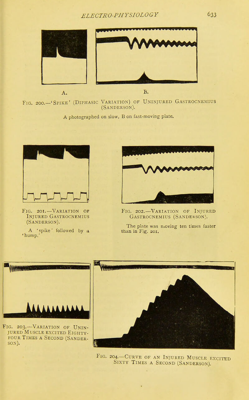Fig. 200.—'Spike' (Diphasic Variation) of Uninjured Gastrocnemius (Sanderson). A photographed on slow, B on fast-moving plate. r\j\r\j\r\ Fig. 201.—Variation of Injured Gastrocnemius (Sanderson). A ■ spike' followed by a ' hump. Fig. 202.—Variation of Injured Gastrocnemius (Sandekson). The plate was nioving ten times faster than in Fig. 201. Fig. 203.—Variation of Unin- jured Muscle excited Eighty- four Times a Second (Sander- son). Fig. 204.—Curve of an Injured Muscle excited Si.xTY Times a Second (Sanderson).